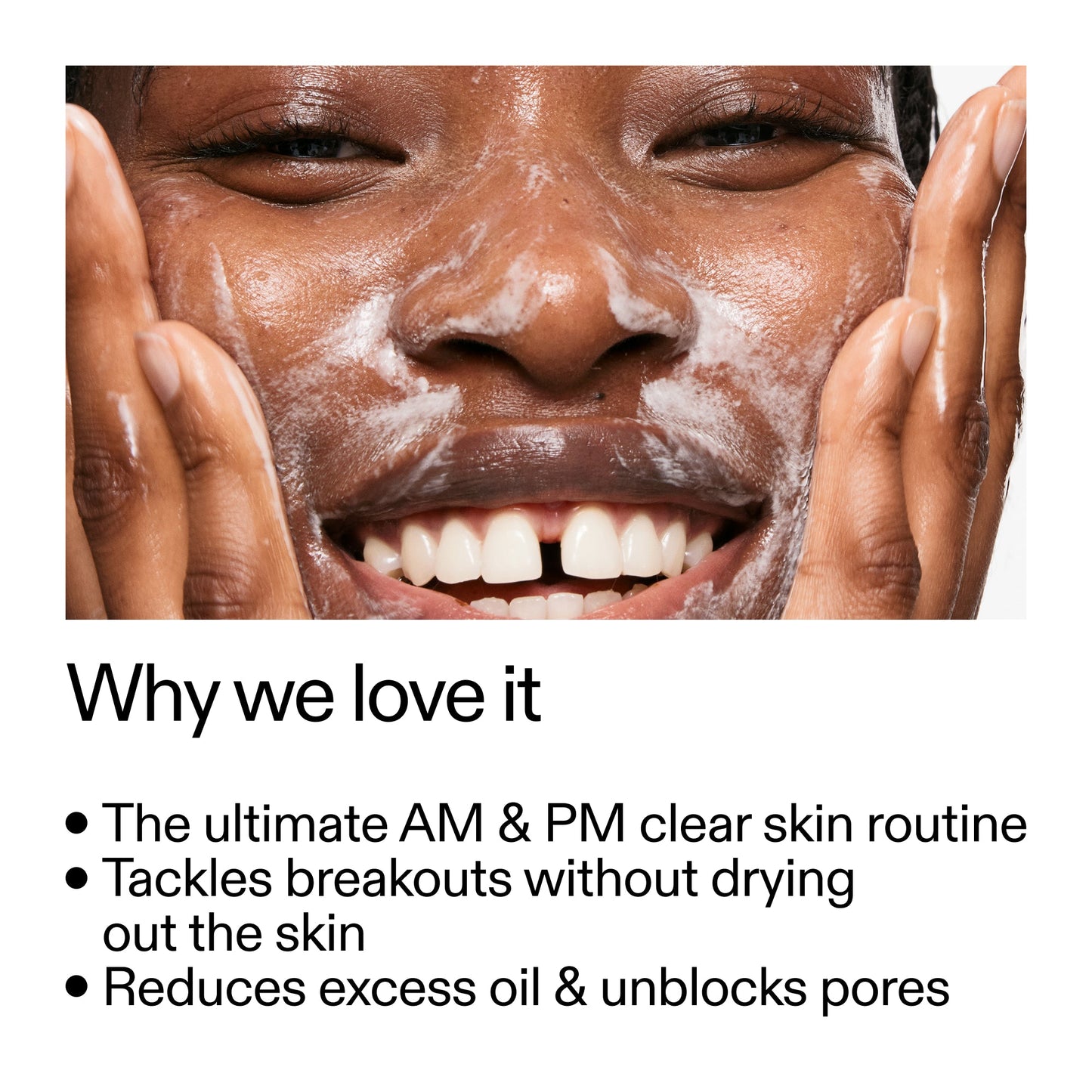 intro-routine-for-acne-d1 Intro_Routine_for_Acne_Why_we_love_it_2000x2000_42499e10-4629-4a0e-a627-7e215f4da6bc.jpg
