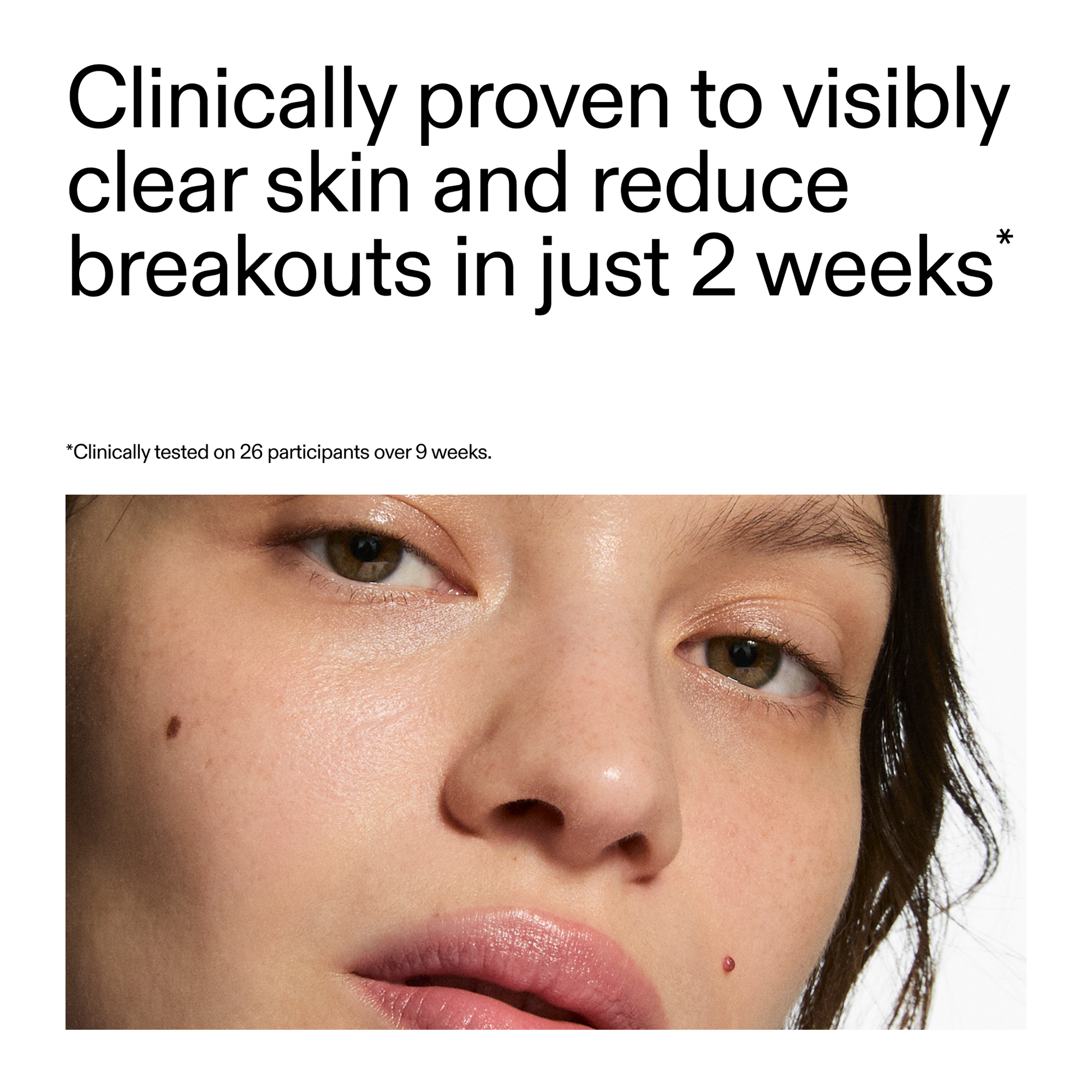 360-acne-clearing-duo-s8 360_Serum_Key_Claim.png