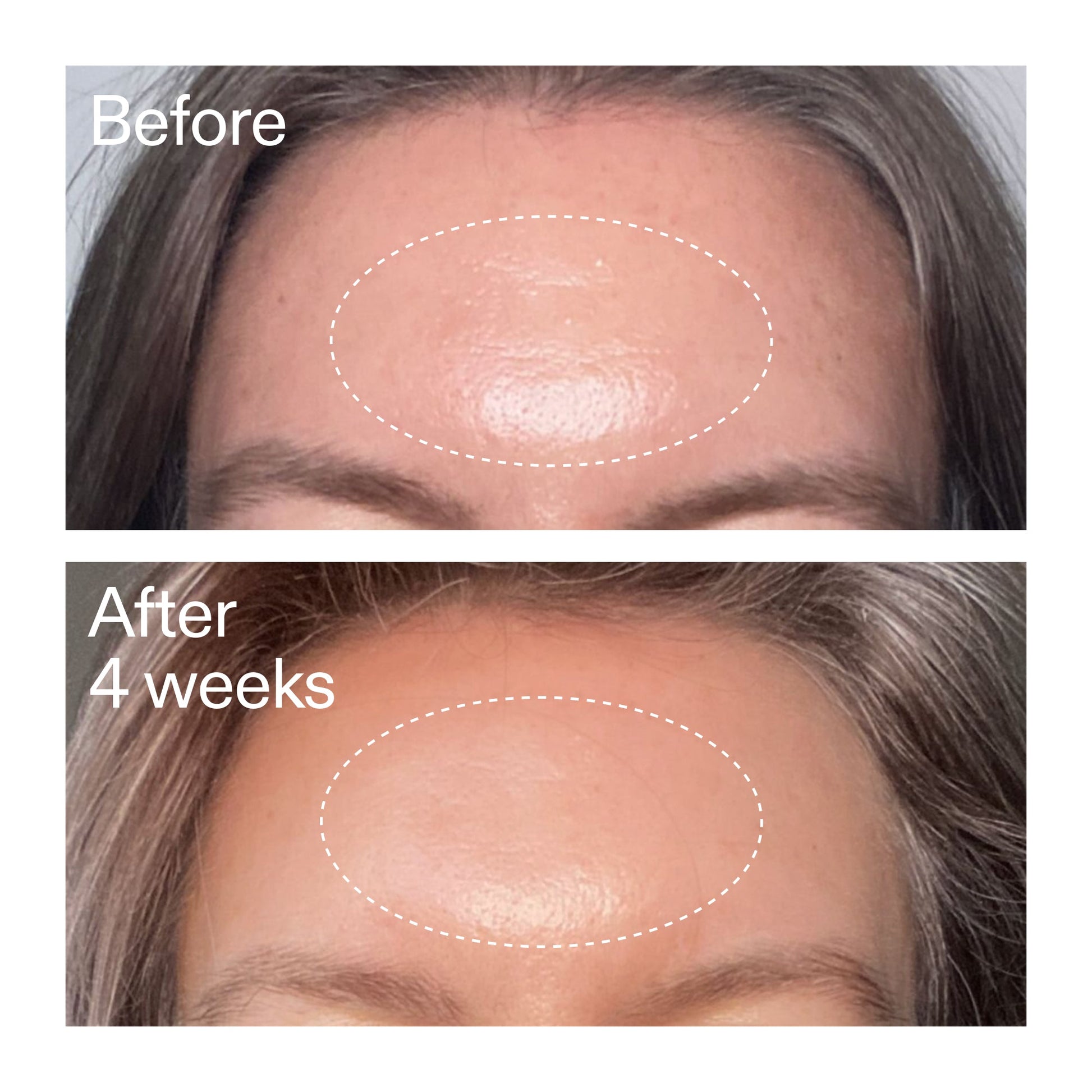 advanced-0-2-retinal-serum-w5 AdvancedRetinal_BeforeAfter1_2000x2000_1da6bb0a-29dd-41d1-95b7-8679696bbf0f.jpg