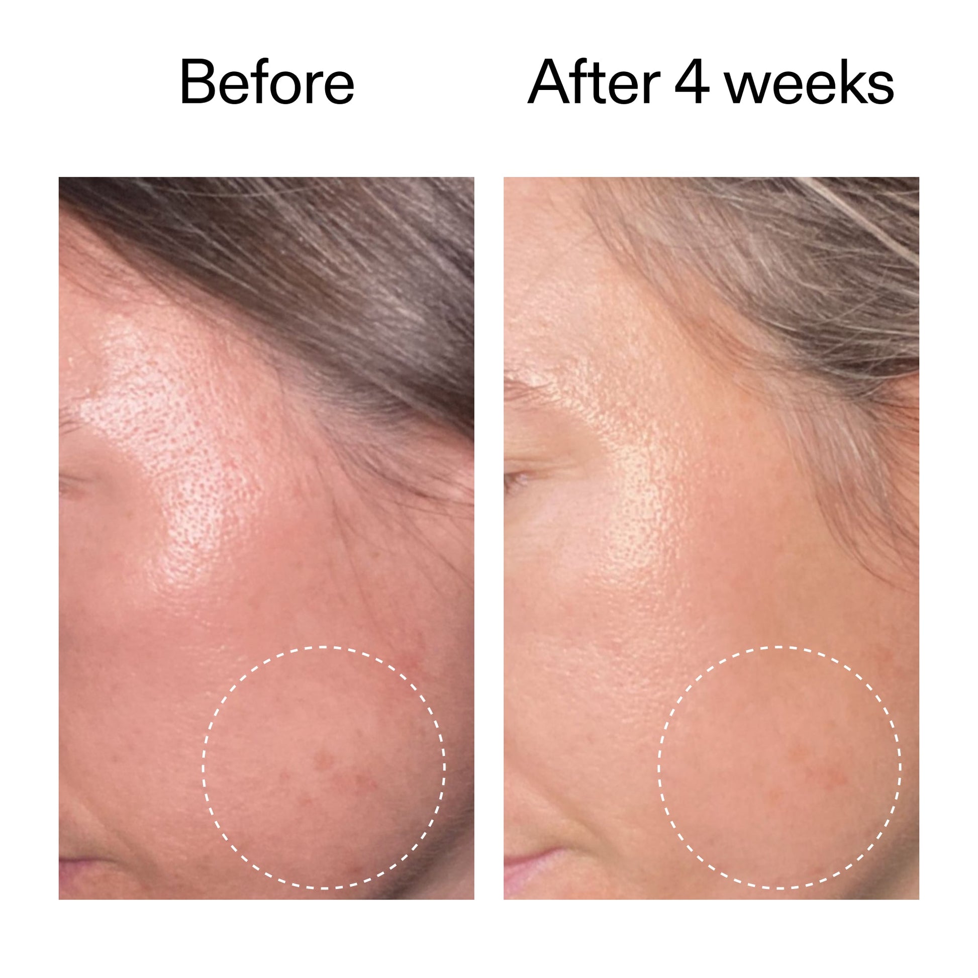 advanced-0-2-retinal-serum-w5 AdvancedRetinal_BeforeAfter2__2000x2000_62fb16bb-77ae-4d63-8500-88dbf847f4b9.jpg