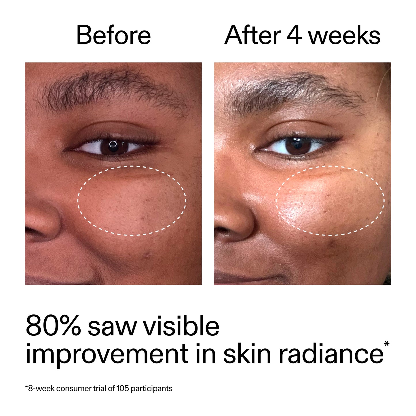advanced-0-2-retinal-serum-w5 AdvancedRetinal_BeforeAfter_Claim2_2000x2000_39d11e3d-eda9-44ec-ab32-2903b1a368bd.jpg