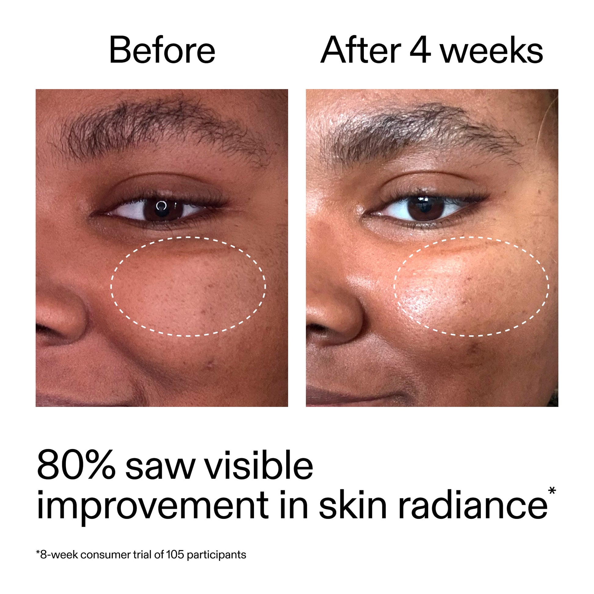 advanced-0-2-retinal-serum-duo-h8 AdvancedRetinal_BeforeAfter_Claim2_2000x2000_681b621d-8d44-4d44-9a40-89244f9b2e53.jpg