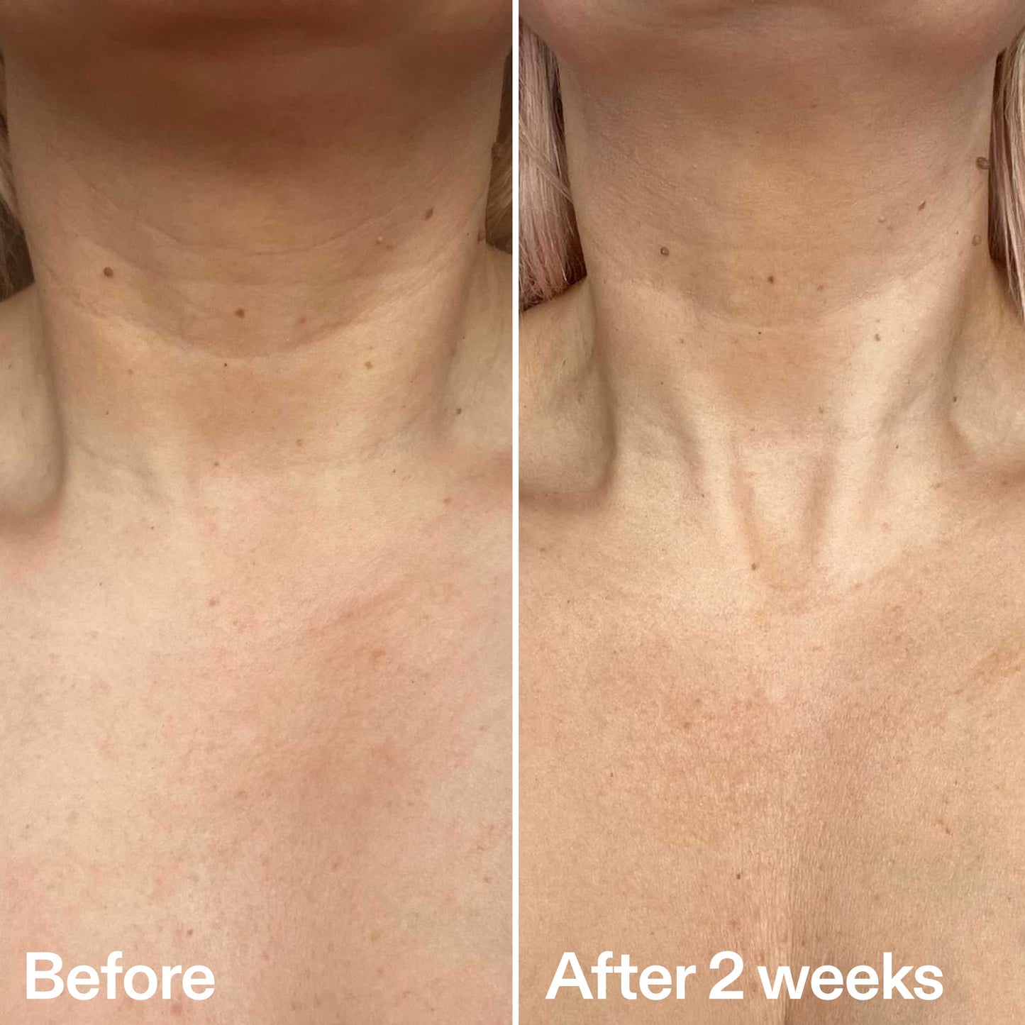 bio-active-neck-lift-stick-z4 B_A_2.jpg