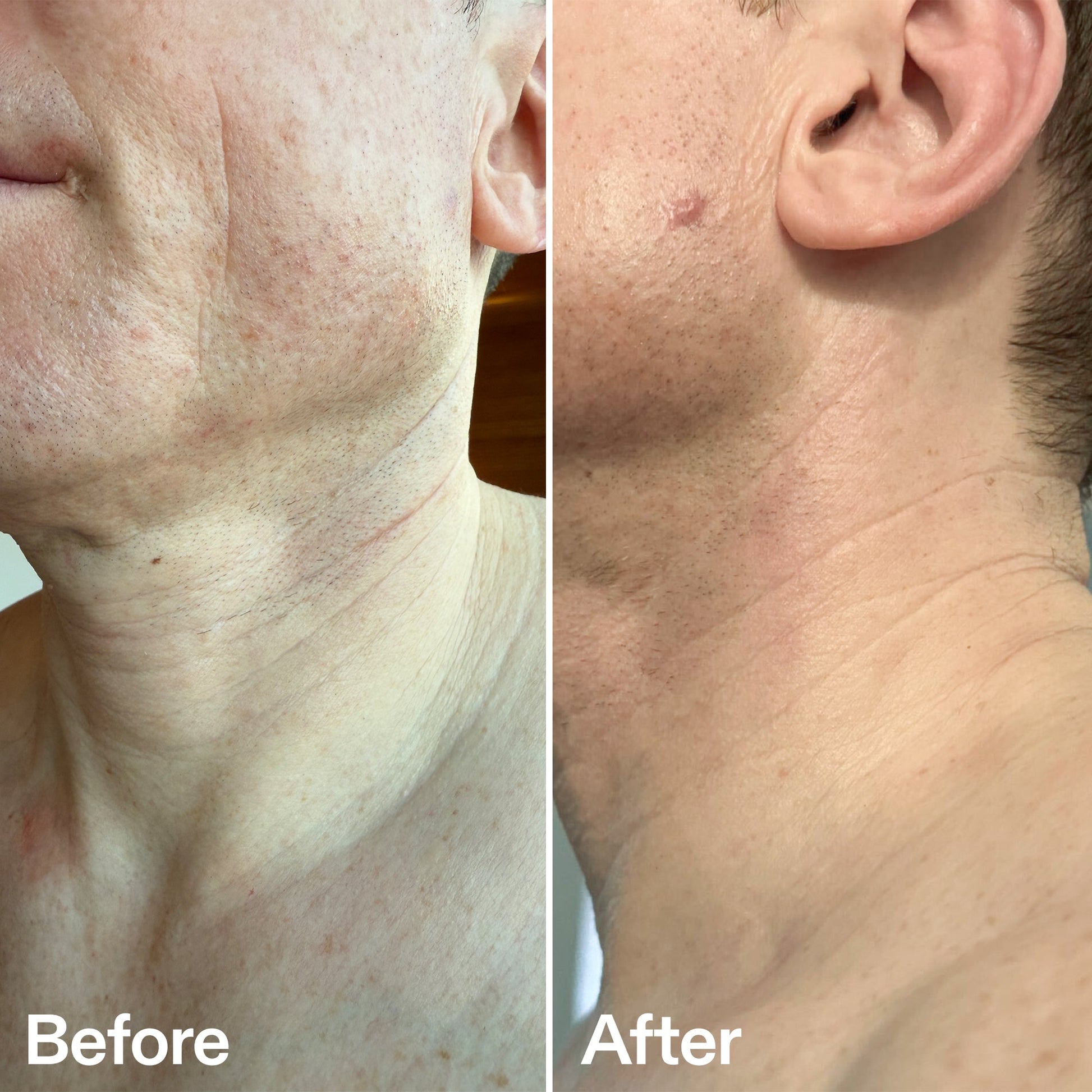 bio-active-neck-lift-stick-z4 B_A_afa2743e-b8e2-4504-92f4-e281cb6cf759.jpg