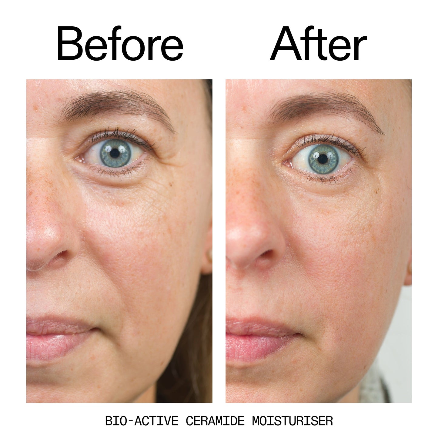 barrier-boosting-trio-m6 Bio-Active_Before_After_2000x2000_600947b4-e8c5-425a-9155-fc15bc83aa12.jpg