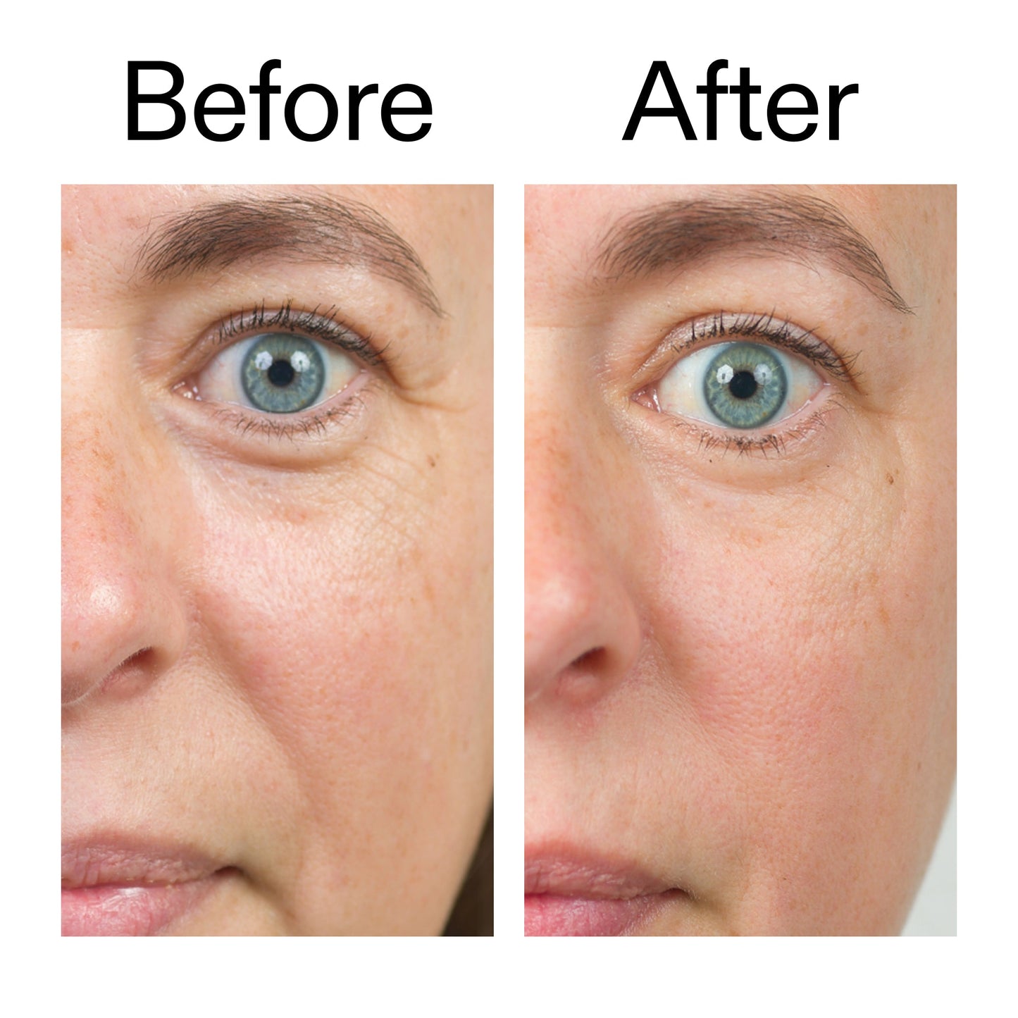 bio-active-ceramide-moisturizer-c5 Bio-Active_Before_After_2000x2000_566e5a9e-135e-417a-8242-b44e5fa35463.jpg