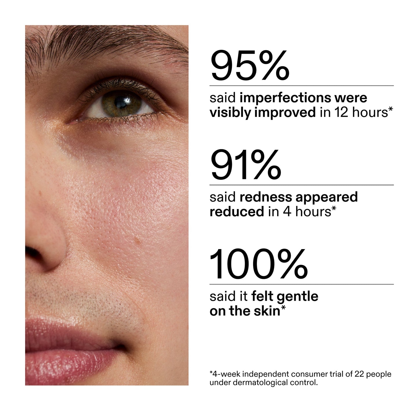 succinic-acid-acne-treatment-p8 CA_Succinic_Acid_Treatment_key_Claims_2000x2000_db91b0f1-7f29-4bfe-bb16-63a47f500960.jpg