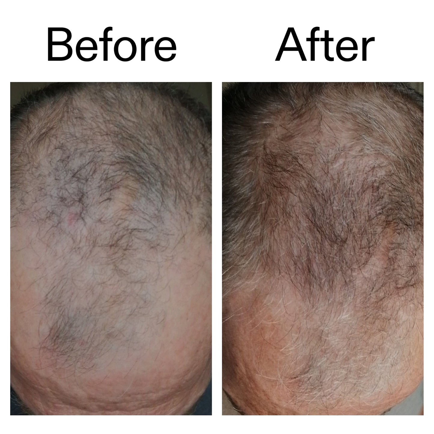 3-month-hair-growth-trio-d5 Caffeine_Scalp_Treatment_B_A_Ppage_2000_x_2000.jpg