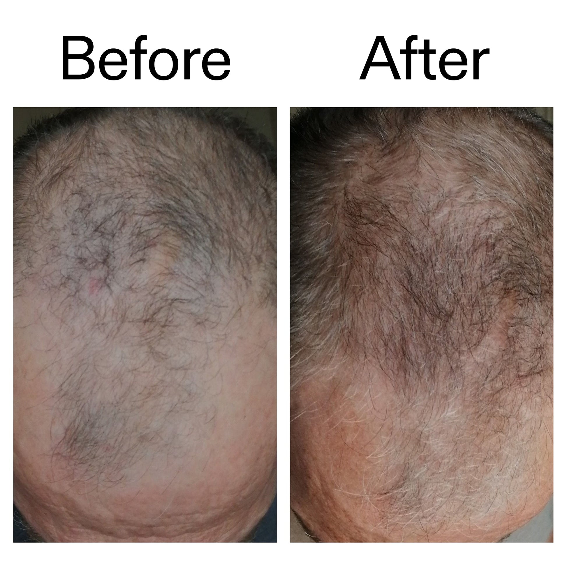 caffeine-stimulating-scalp-treatment-j6 Caffeine_Scalp_Treatment_B_A_Ppage_2000_x_2000.jpg