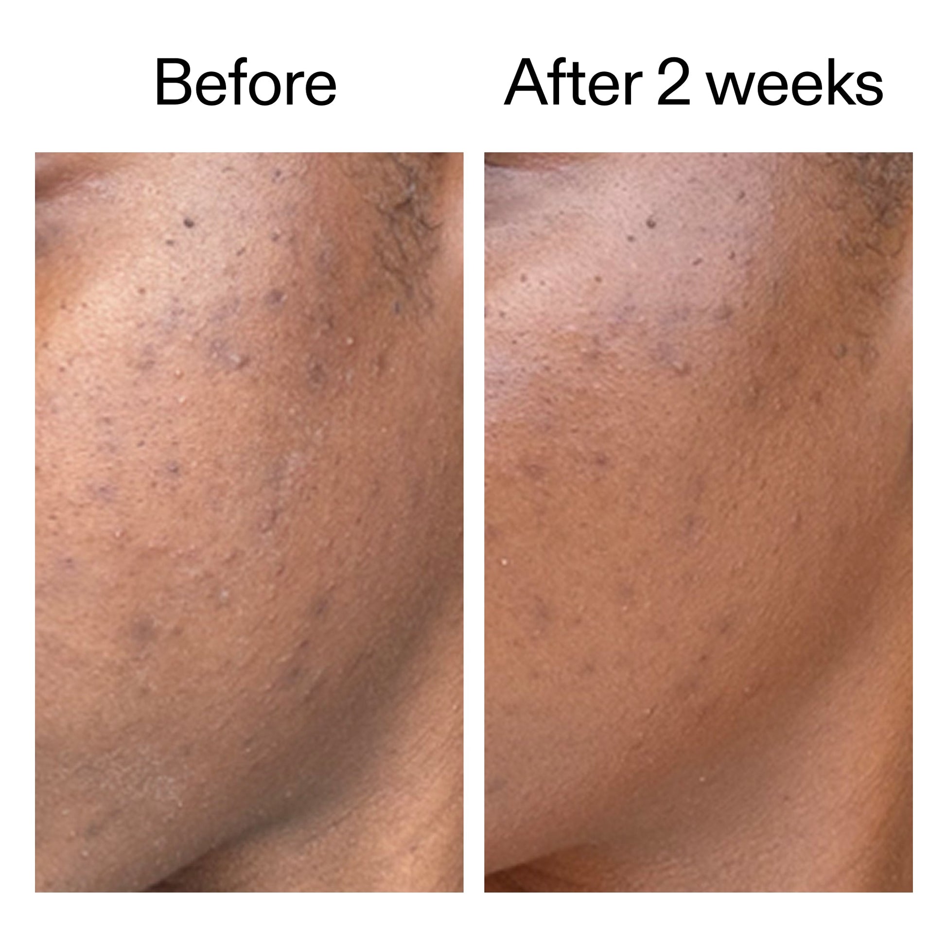 360-acne-clearing-serum-w4 DIOICB_A2000x2000.jpg
