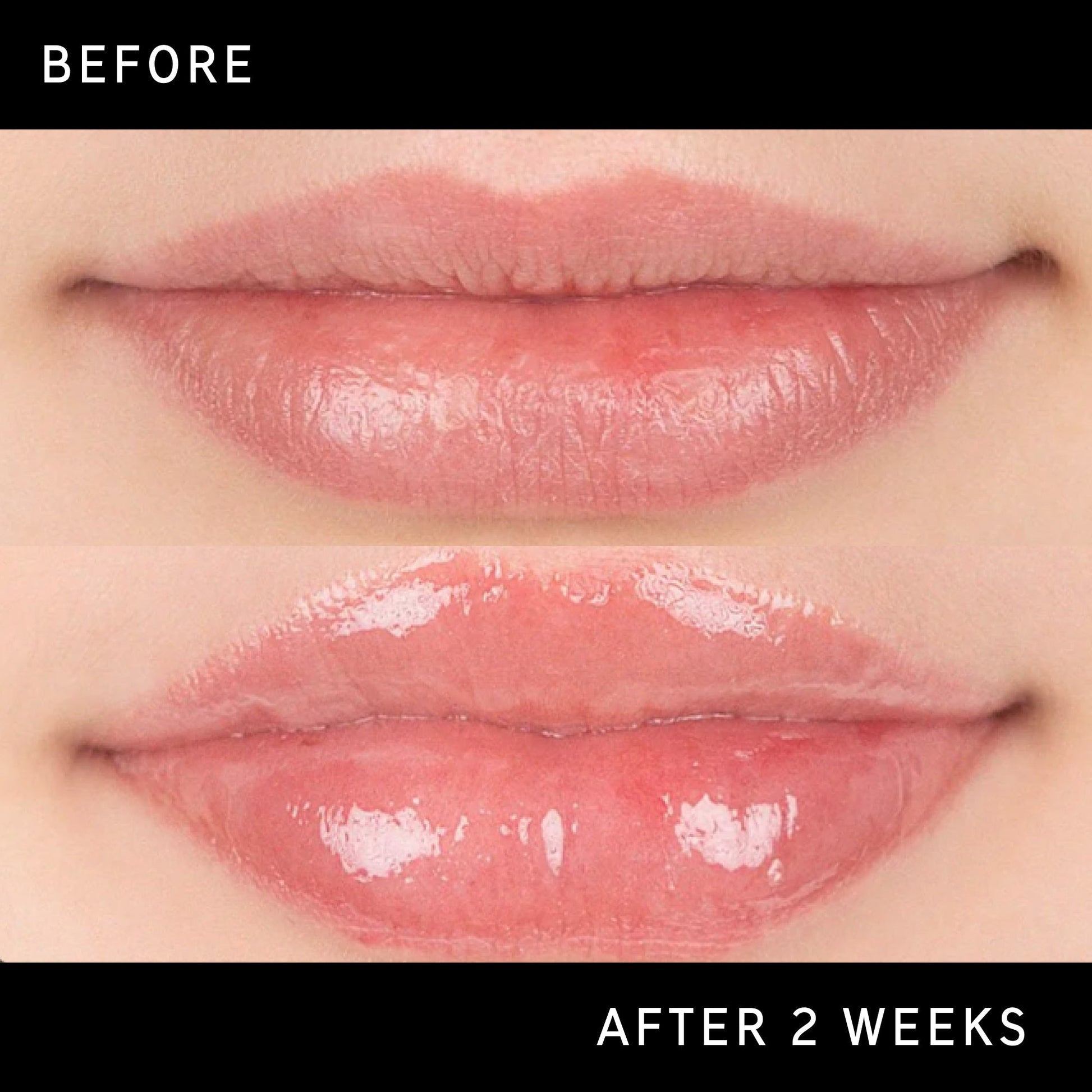 lip-plumping-duo-v0 DTC-Top15_Amends_Tripeptide-Lip_B_A.jpg