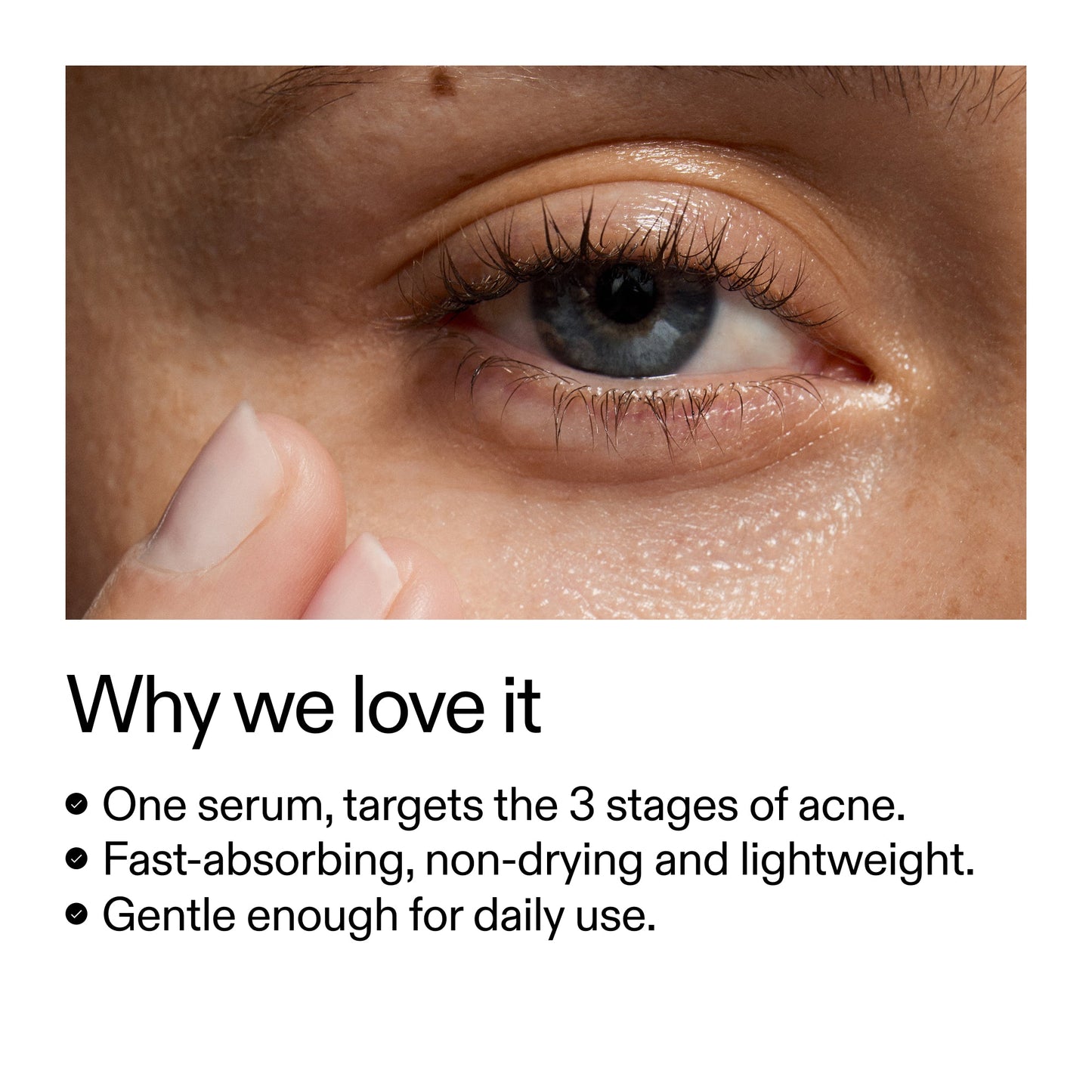 360-acne-clearing-duo-s8 Dioic_Whyweloveit_2000x2000_175aafd3-0cbe-403a-b317-a8362881bfe2.jpg