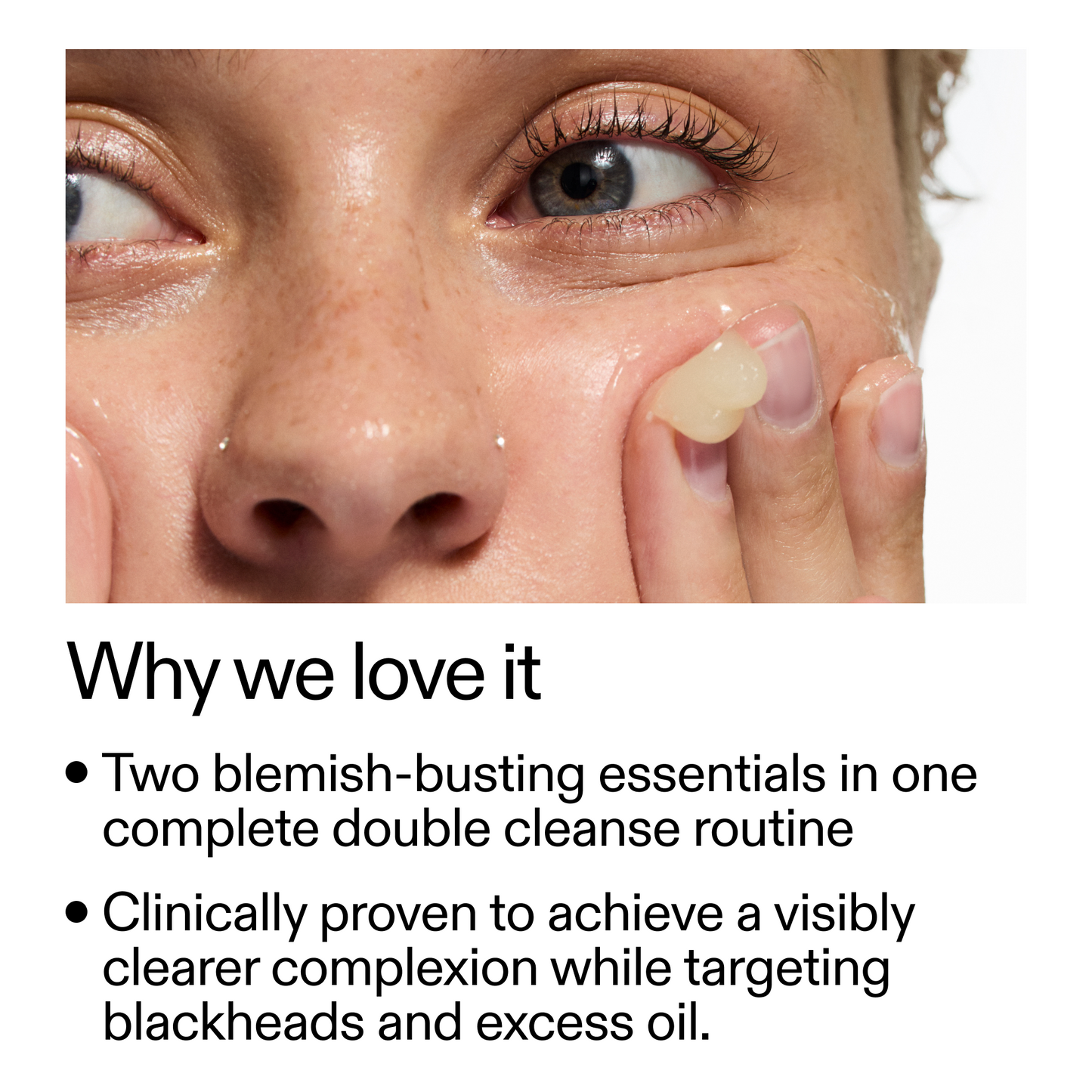 acne-double-cleanse-duo-z0 Double_Cleanse_Duo_for_Breakouts_Why_We_2000x2000_f242cb12-bb5c-487c-b203-071ccb406ec5.png