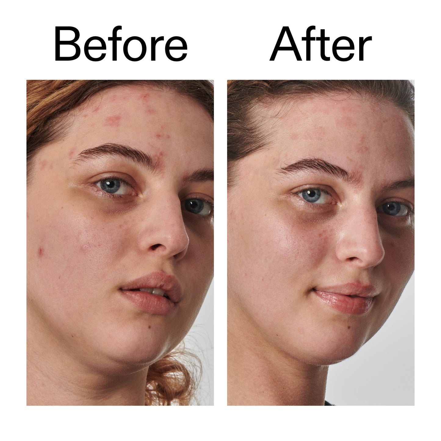 10-urea-moisturizer-a7 Dry_and_Rough_Skin_Solution_Before_After_2000x2000_efa6e639-5c39-49bd-a5dd-f0220293120a.jpg