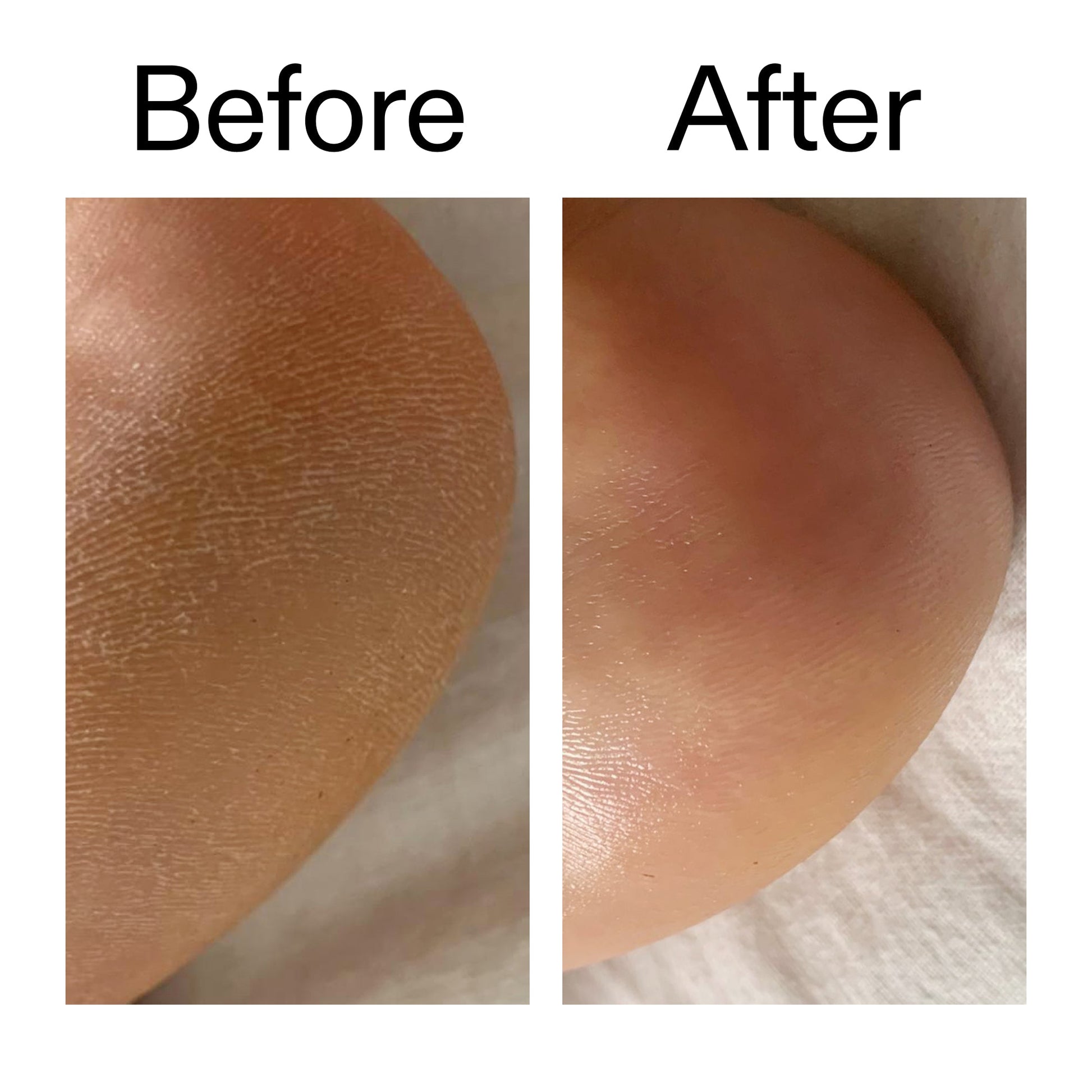 glycolic-acid-exfoliating-body-stick-duo-x1 Glycolic_Acid_Exfoliating_Body_Stick_Before_After_V1_2000x2000_a3043625-9400-429a-a7fb-d6dbd220f722.jpg