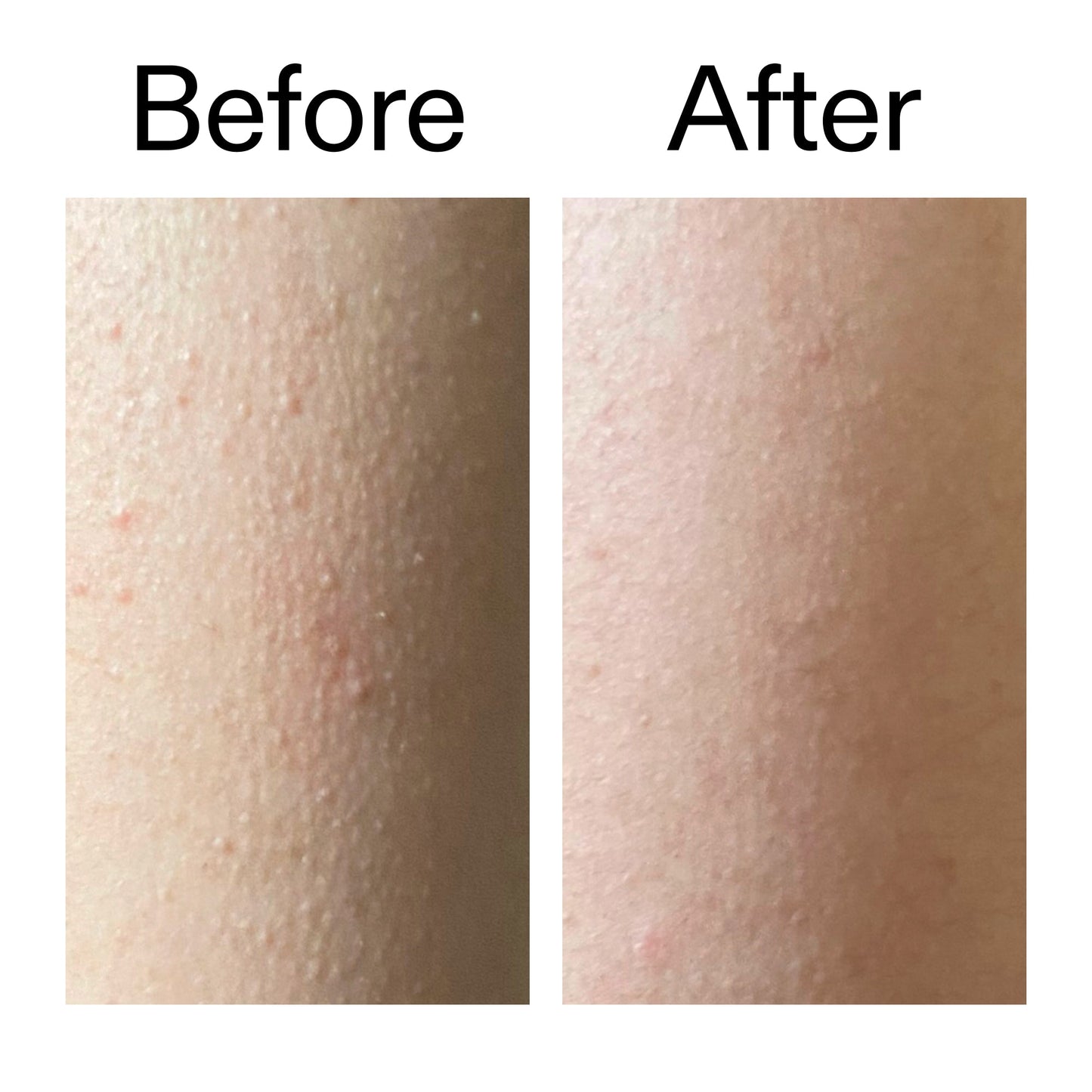 glycolic-acid-exfoliating-body-stick-duo-x1 Glycolic_Acid_Exfoliating_Body_Stick_Before_After_V2_2000x2000_2e4ba052-94f6-4d56-82df-7bdb5b2df7ae.jpg