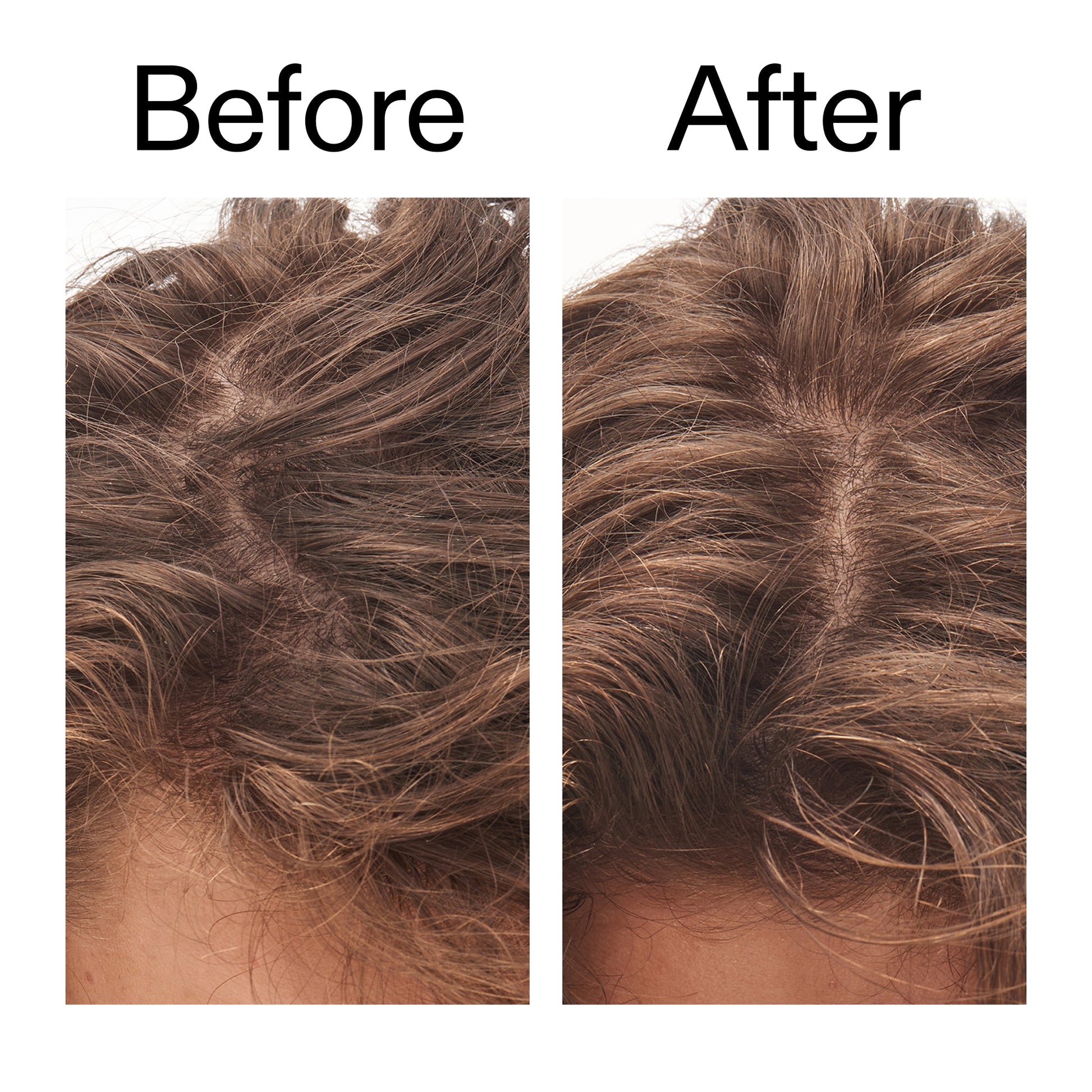 glycolic-acid-exfoliating-scalp-scrub-j7 Glycolic_Acid_Exfoliating_Scalp_Scrub_Before_After_2000x2000_b8561c87-05a1-4caa-80f7-1b6b33d750f7.jpg