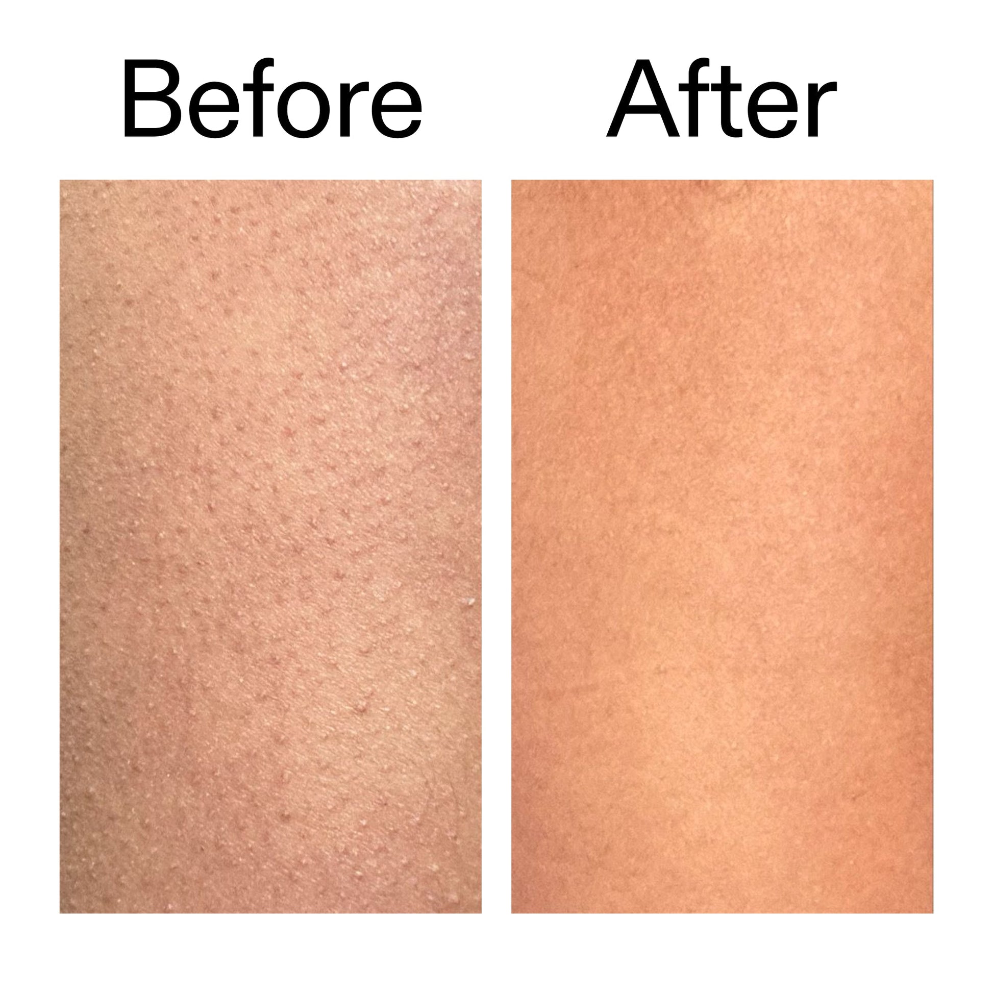 glycolic-acid-exfoliating-body-stick-o0 Glycolic_Body_Stick_B_A_2000x2000_6e6e6b4d-5bd7-43c0-aeed-4d66788e8995.jpg