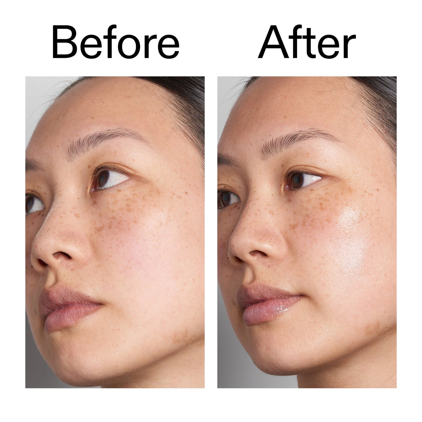 hyaluronic-acid-serum-60ml-duo-y5 Hyaluronic_Acid_Before_After_2000x2000_d566f5ba-a77e-4585-99fd-0f4682b164dd.jpg
