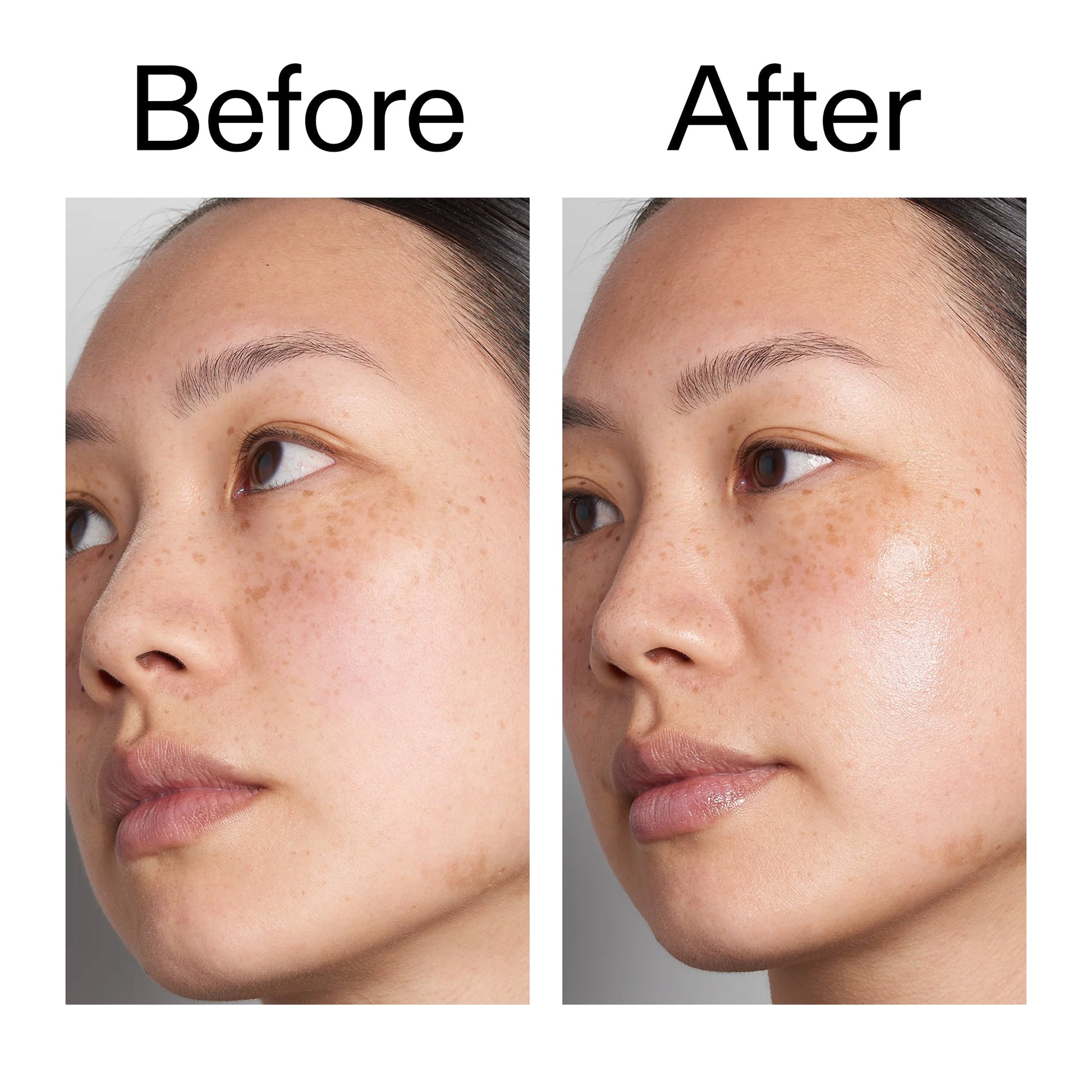 hyaluronic-acid-serum-60ml-duo-y5 Hyaluronic_Acid_Before_After_2000x2000_d566f5ba-a77e-4585-99fd-0f4682b164dd.jpg