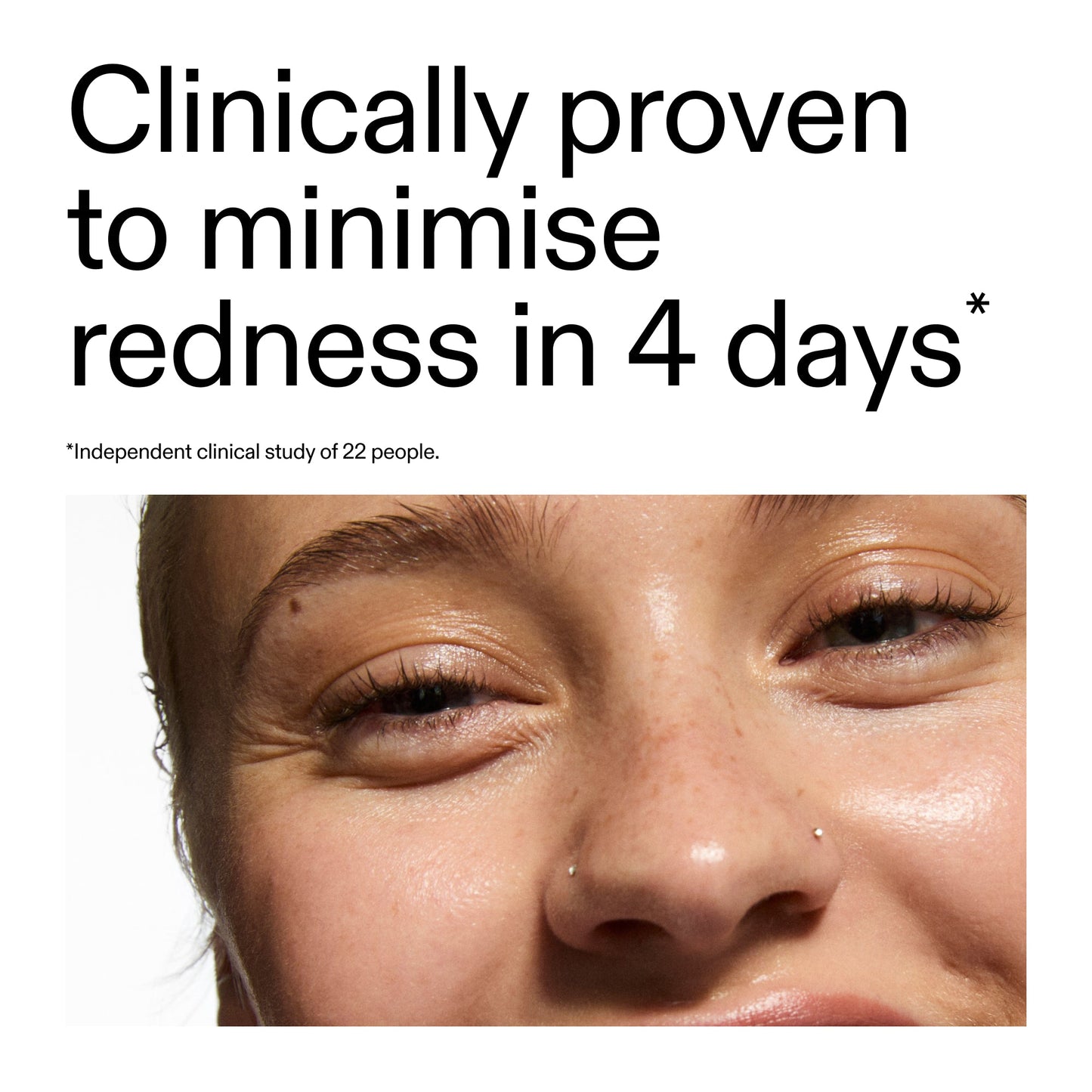 10-azelaic-acid-serum-for-redness-relief-b3 Oat_Cleansing_Balm_Claim_2000x2000_52a841dc-353c-4f2c-8646-3aadb604507d.jpg