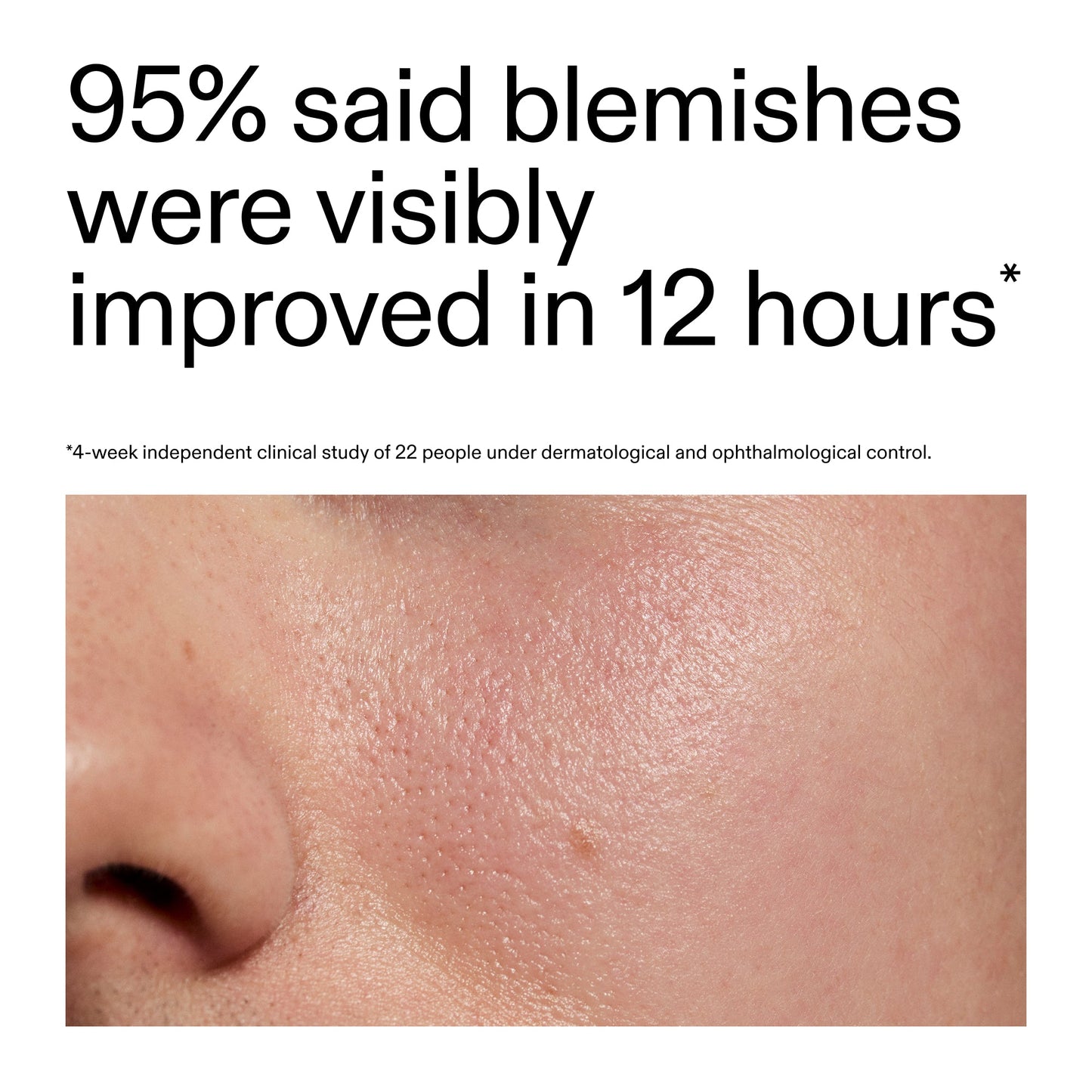 succinic-acid-acne-treatment-p8 Oat_Cleansing_Balm_Claim_2000x2000_ac6ce553-25db-41b2-a981-faae1ac4b8c0.jpg