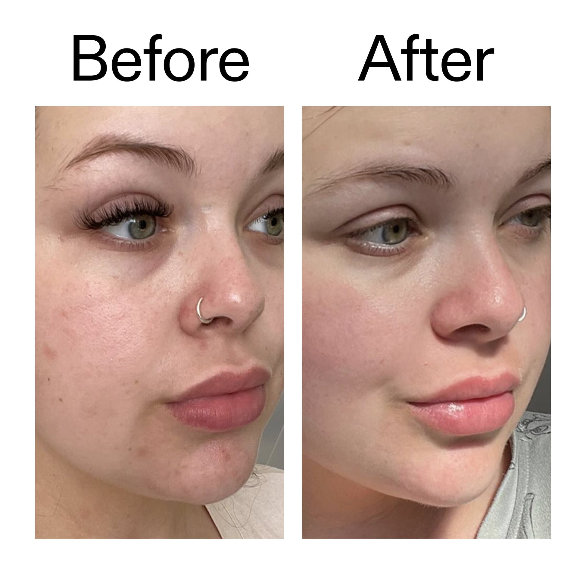 supersize-omega-water-cream-duo-r1 Omega50_Before_After_2000x2000_46483ed8-3f9d-487f-9a0c-9df79830bd65.jpg