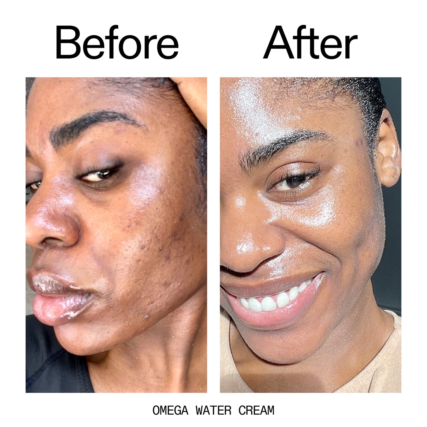 glowing-skin-set-n4 Omega_Water_Cream_Before_After_2000x2000_8e88278b-8c8d-48dc-ac77-4e98ebbd1b77.jpg