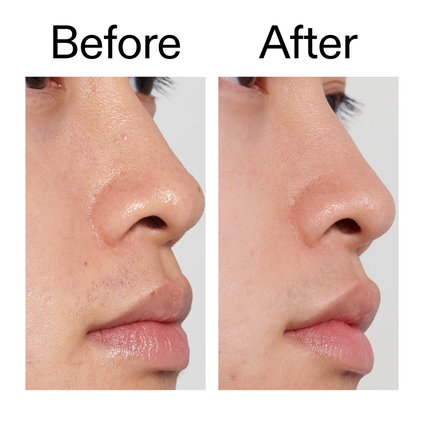 pha-toner-k7 PHA_Toner_Before_After_2000x2000_e3c10172-0150-4342-8b95-57417eaff50d.jpg