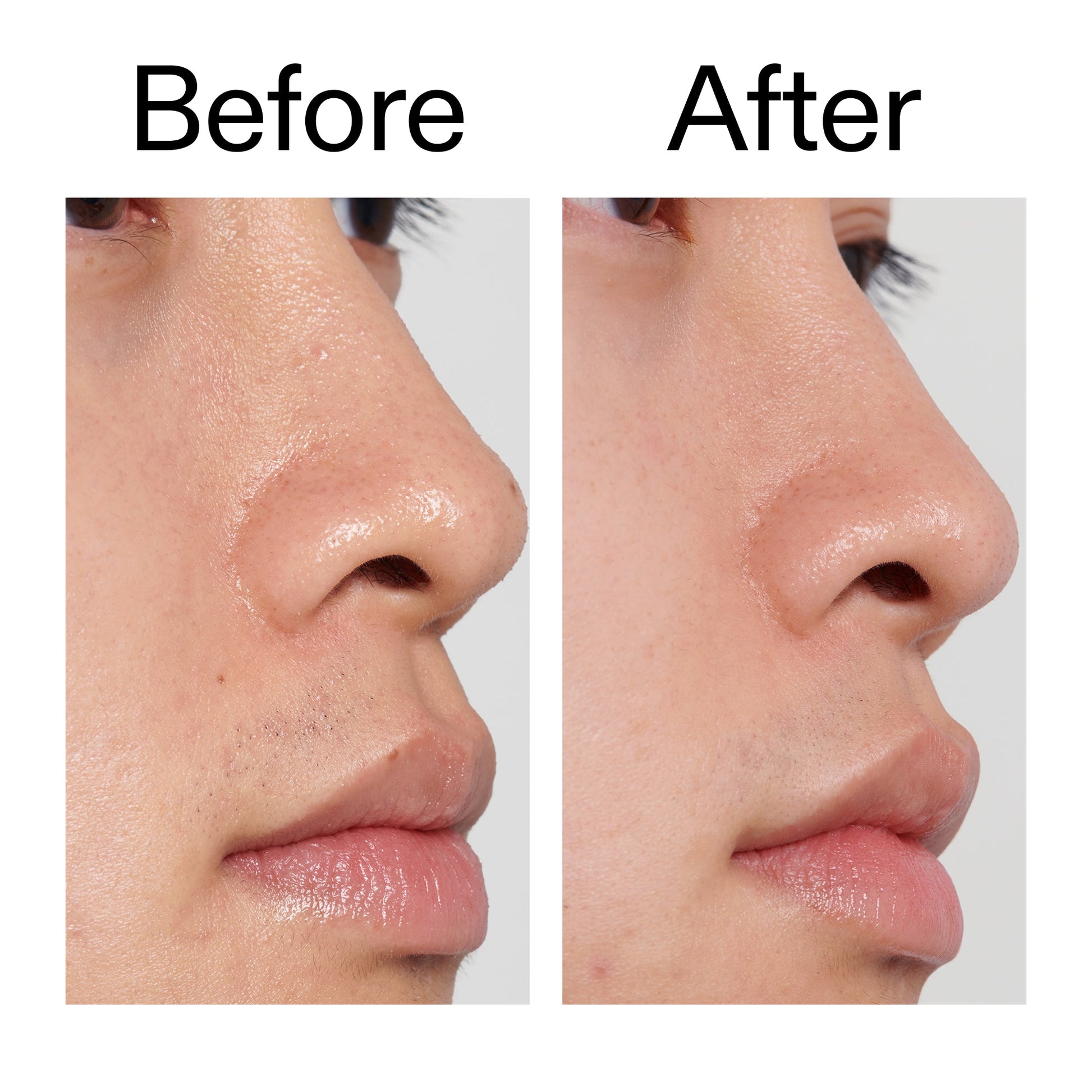 pha-toner-k7 PHA_Toner_Before_After_2000x2000_e3c10172-0150-4342-8b95-57417eaff50d.jpg