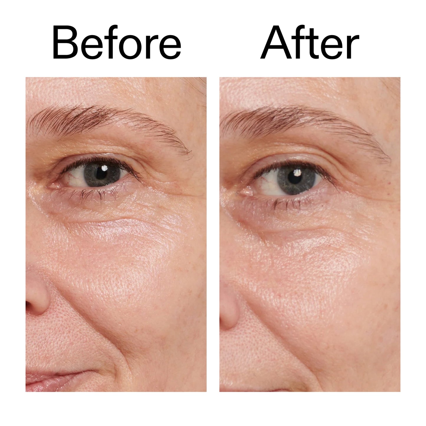 retinol-eye-cream-s6 Retinol_Eye_Cream_Before_After_2000x2000_ac03a80c-109e-4572-a95a-91dc109b4d27.jpg