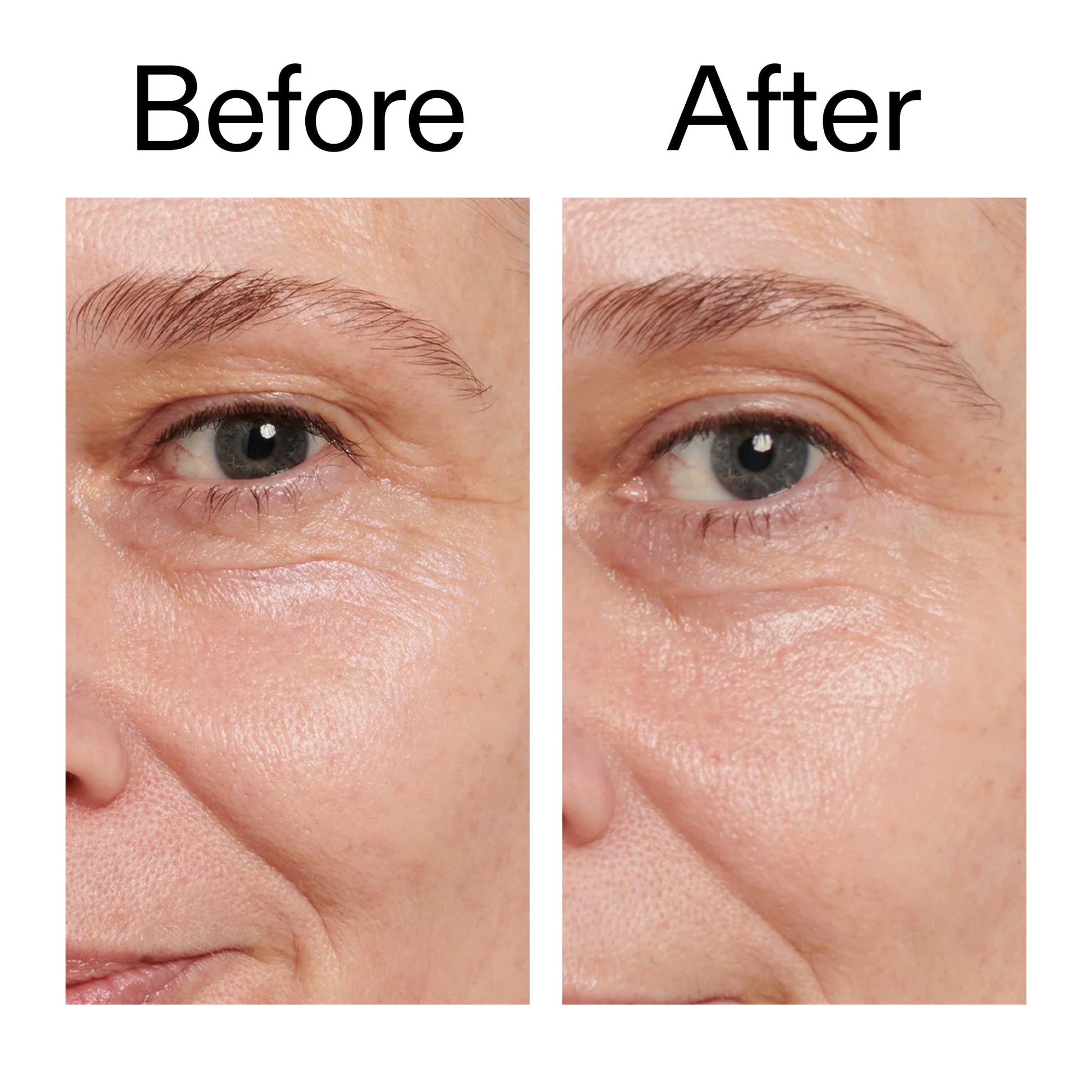 retinol-eye-cream-s6 Retinol_Eye_Cream_Before_After_2000x2000_ac03a80c-109e-4572-a95a-91dc109b4d27.jpg