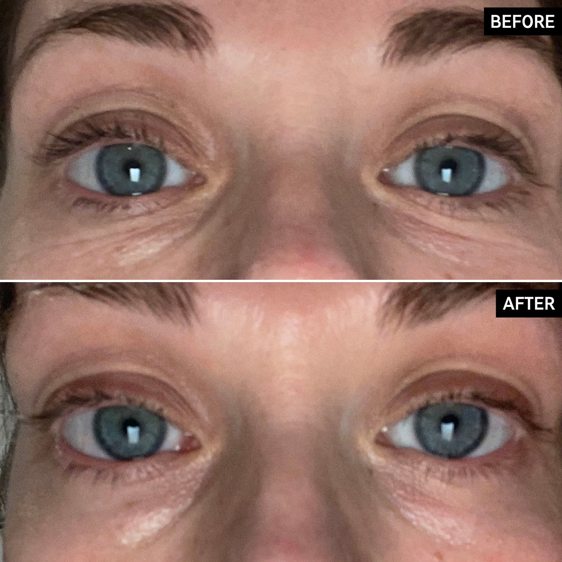 retinol-eye-cream-s6 SITE-UGCBAsApril_Nicole_B_A_PPage_2000x2000_1.jpg