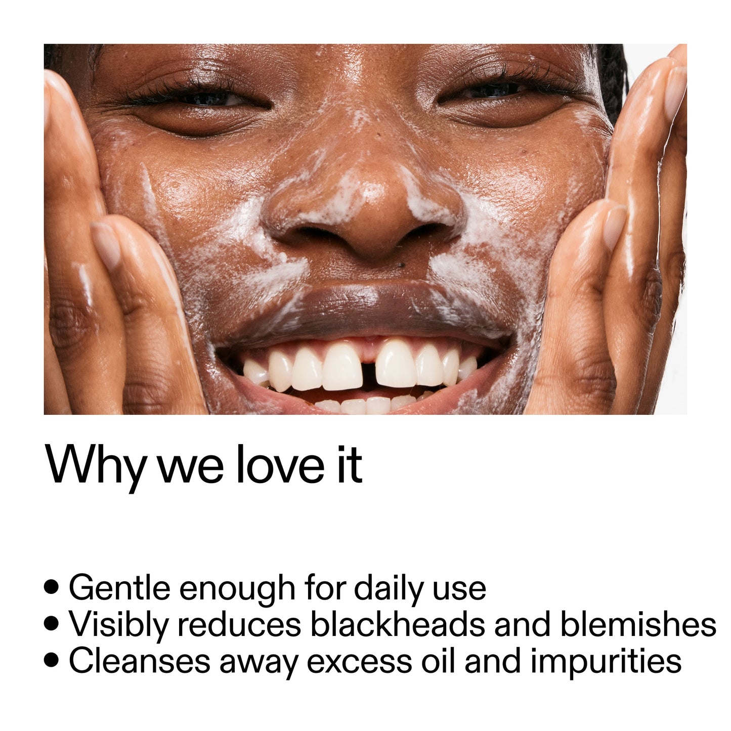 salicylic-acid-cleanser-150ml-o6 Salicylic_Acid_Cleanser_-_300mlWhy_we_love_it_2000x2000_87dc92a9-2559-4309-98cd-4e570f1be735.jpg