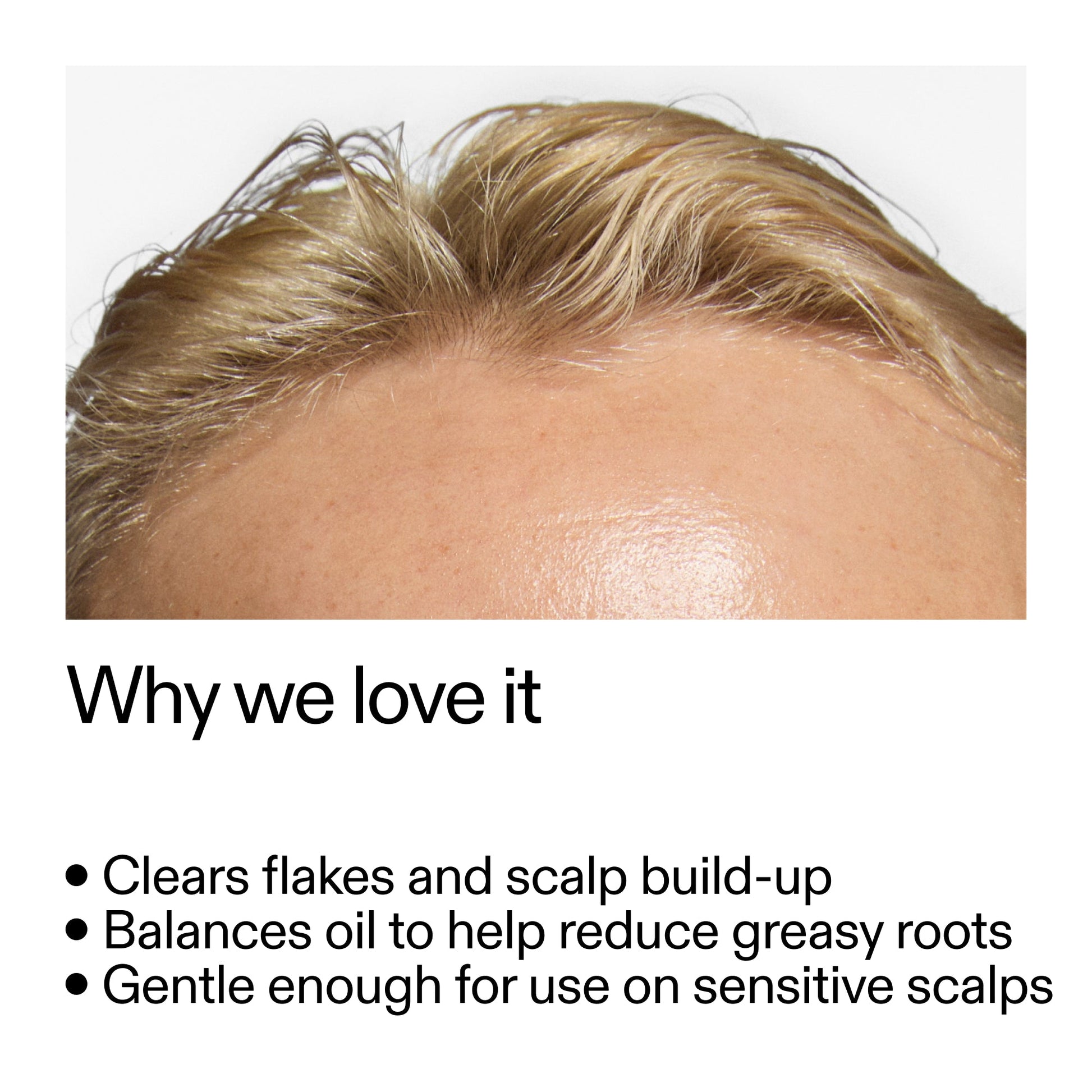 salicylic-acid-exfoliating-scalp-treatment-x4 Salicylic_Acid_Exfoliating_Scalp_Treatment_Why_we_love_it_2000x2000_44b6bd6d-9ec4-4b23-9dc4-bc3fd6f28e14.jpg