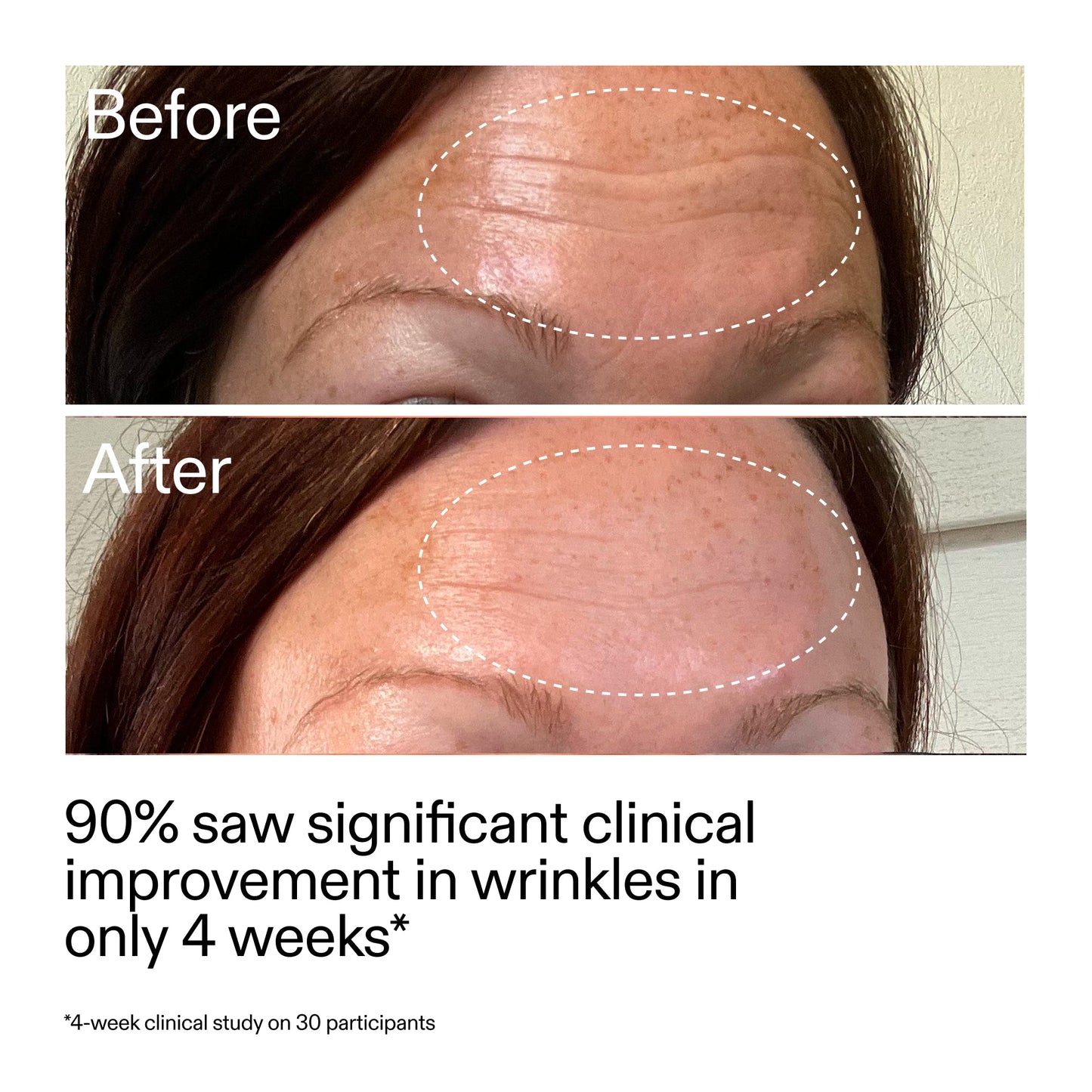 starter-retinol-serum-duo-l0 StarterRetinol_BeforeAfter_Claim1_2000x2000_03b4d6e5-a357-43b9-a855-aba5e35c57f3.jpg