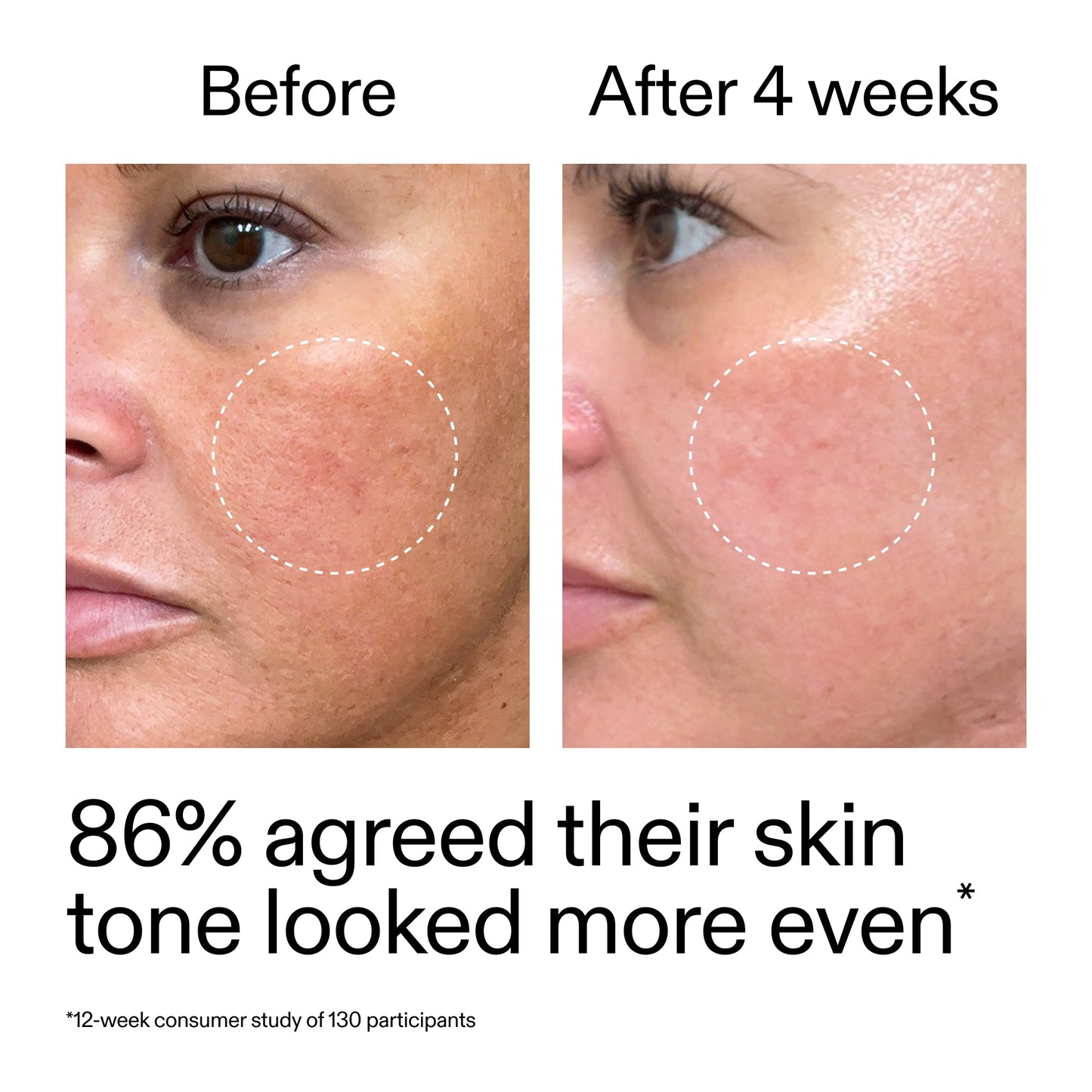 starter-retinol-serum-x1 StarterRetinol_BeforeAfter_Claim2_2000x2000_f5c9ecc0-8d76-429d-bef5-c3a61bcf5c09.jpg