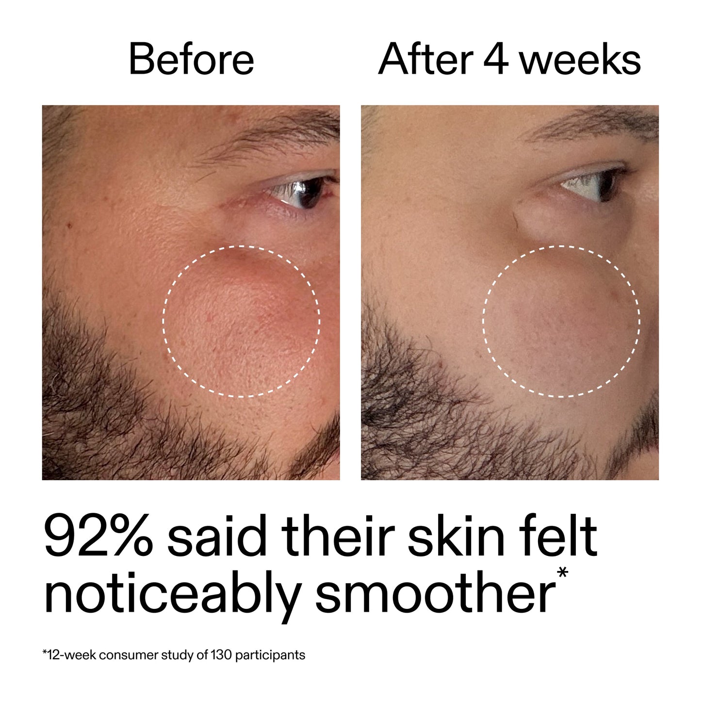 starter-retinol-serum-x1 StarterRetinol_BeforeAfter_Claim3_2000x2000_6ceab106-e0ee-4ed4-ba62-41bc39538038.jpg