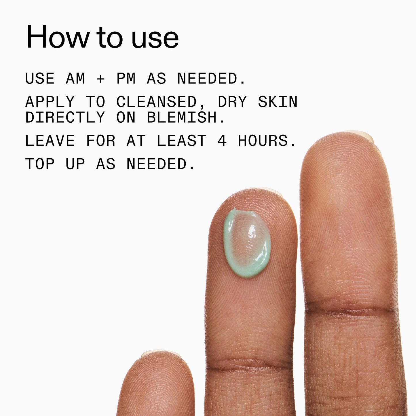 succinic-acid-acne-treatment-p8 Succinic_Acid_Treatment_How_to_Use_2000x2000_d57137d5-d7f1-427c-9a46-5fc00c19c542.jpg