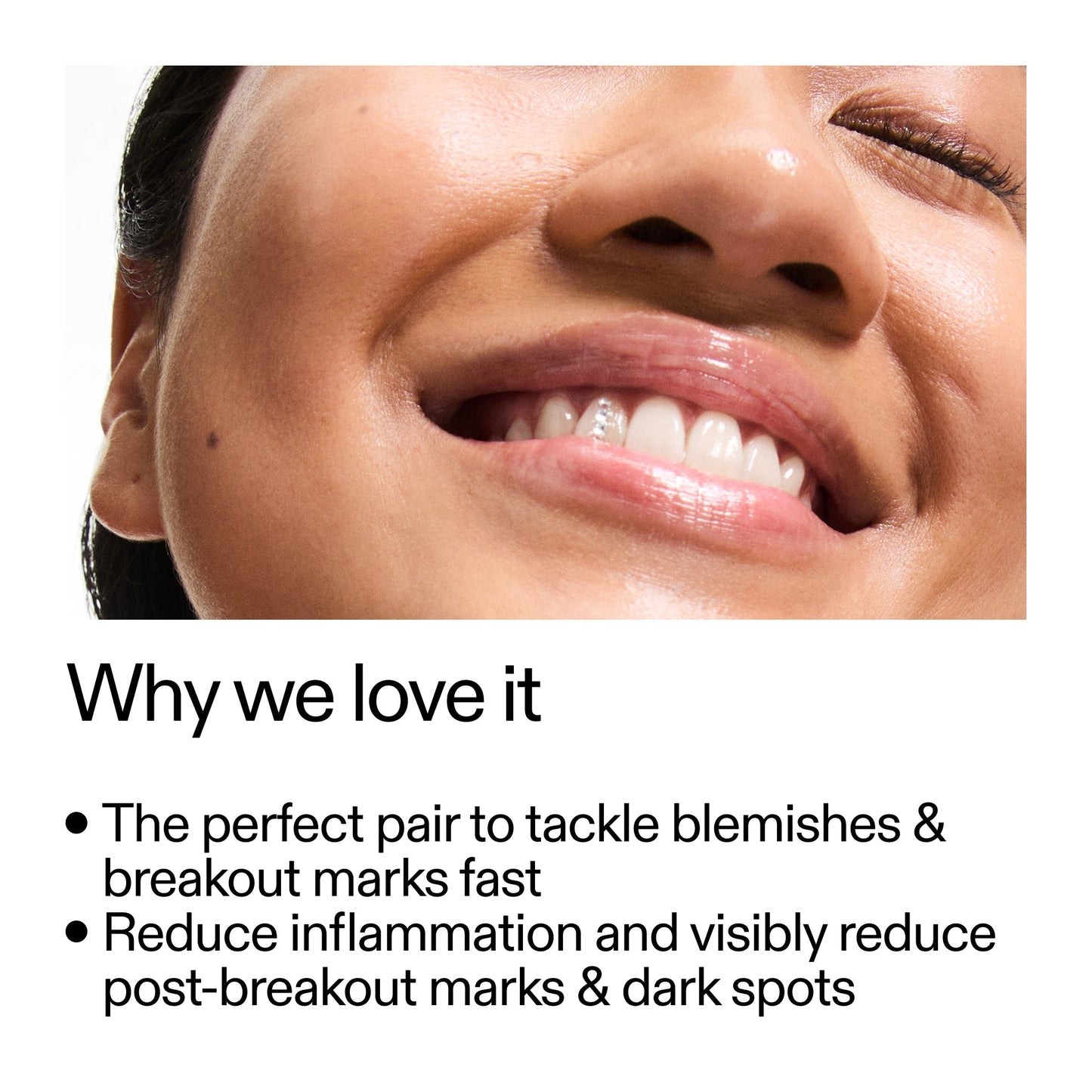 targeted-blemish-duo-v0 Targeted_Blemish_Duo_Why_we_love_it_2000x2000_ff00be46-438b-485f-b5c3-91e60bbb6919.jpg