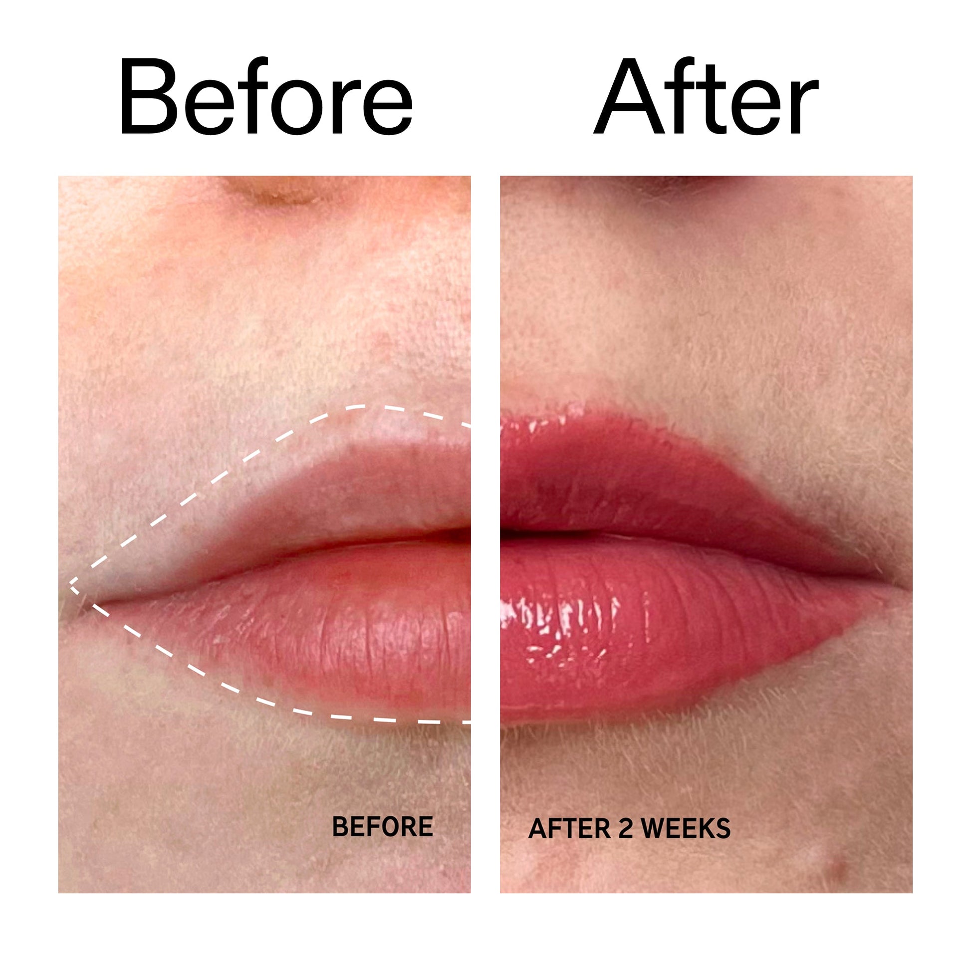 tripeptide-plumping-berry-lip-balm-u4 Tripeptide_Plumping_Lip_Balm_-_Berry_Before_After_2000x2000_9474bbd8-43ca-4b0e-b0e7-dfab70b91927.jpg