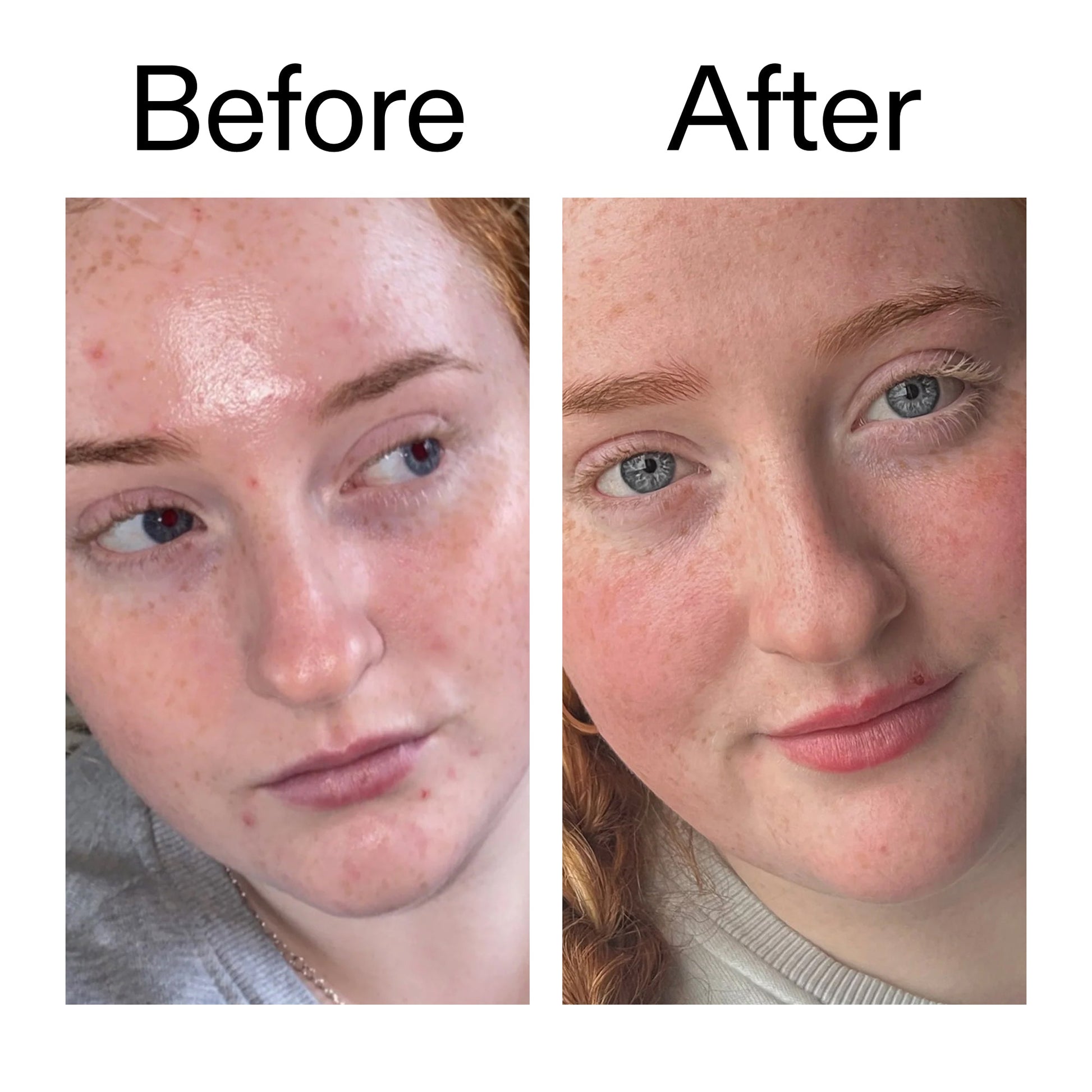 vitamin-b-c-and-e-moisturizer-z5 Vitamin_B_C_and_E_Moisturizer_Before_After_2000x2000_b0781a76-5ad2-4be9-95b8-ef92b356833c.jpg